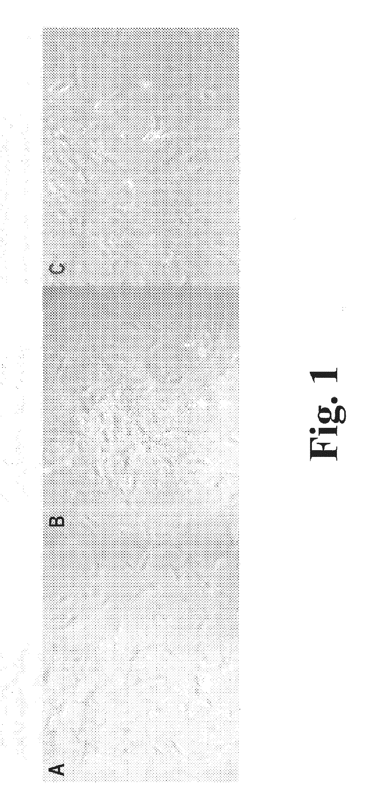 Methods of producing stem cell conditioned media to treat mammalian injuries or insults