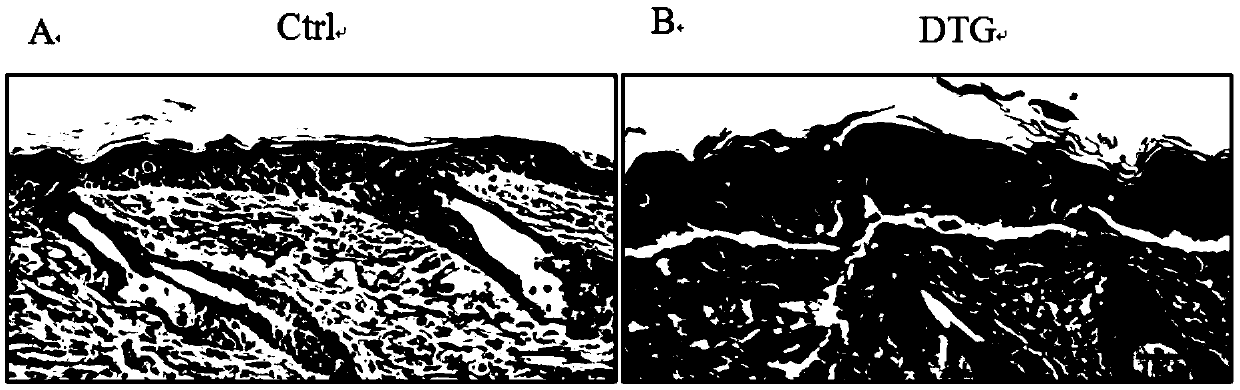 application of Largozole in preparation of drug for treating diseases caused by Msi1 gene ectopic overexpression