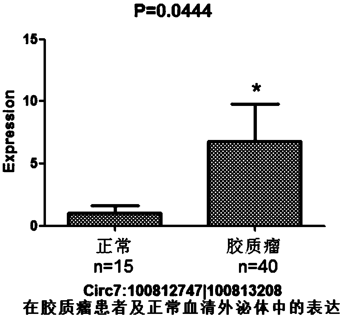 Glioma diagnostic marker circ7:100812747|100813208 and application