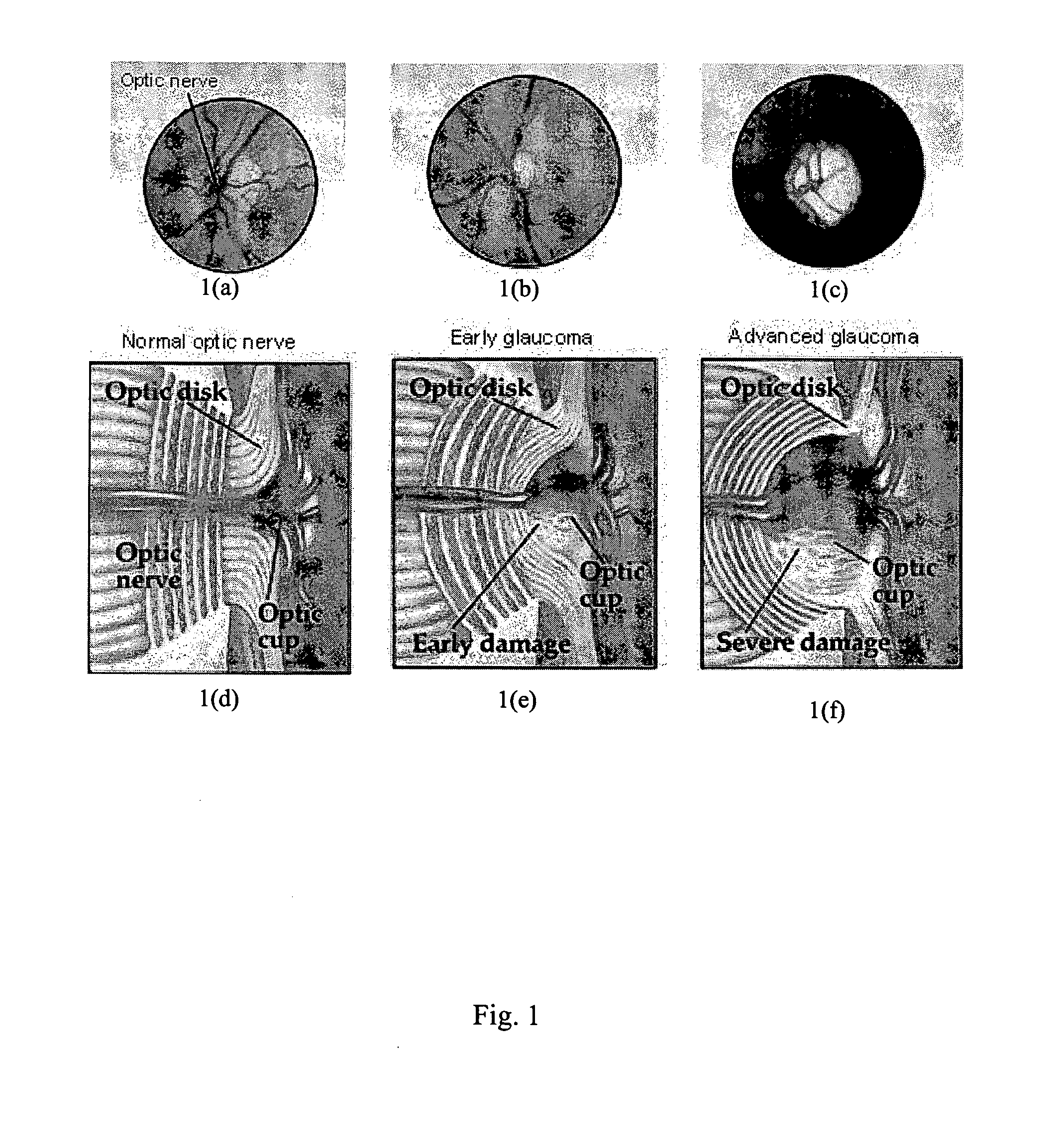Method and system for determining the position of an optic cup boundary