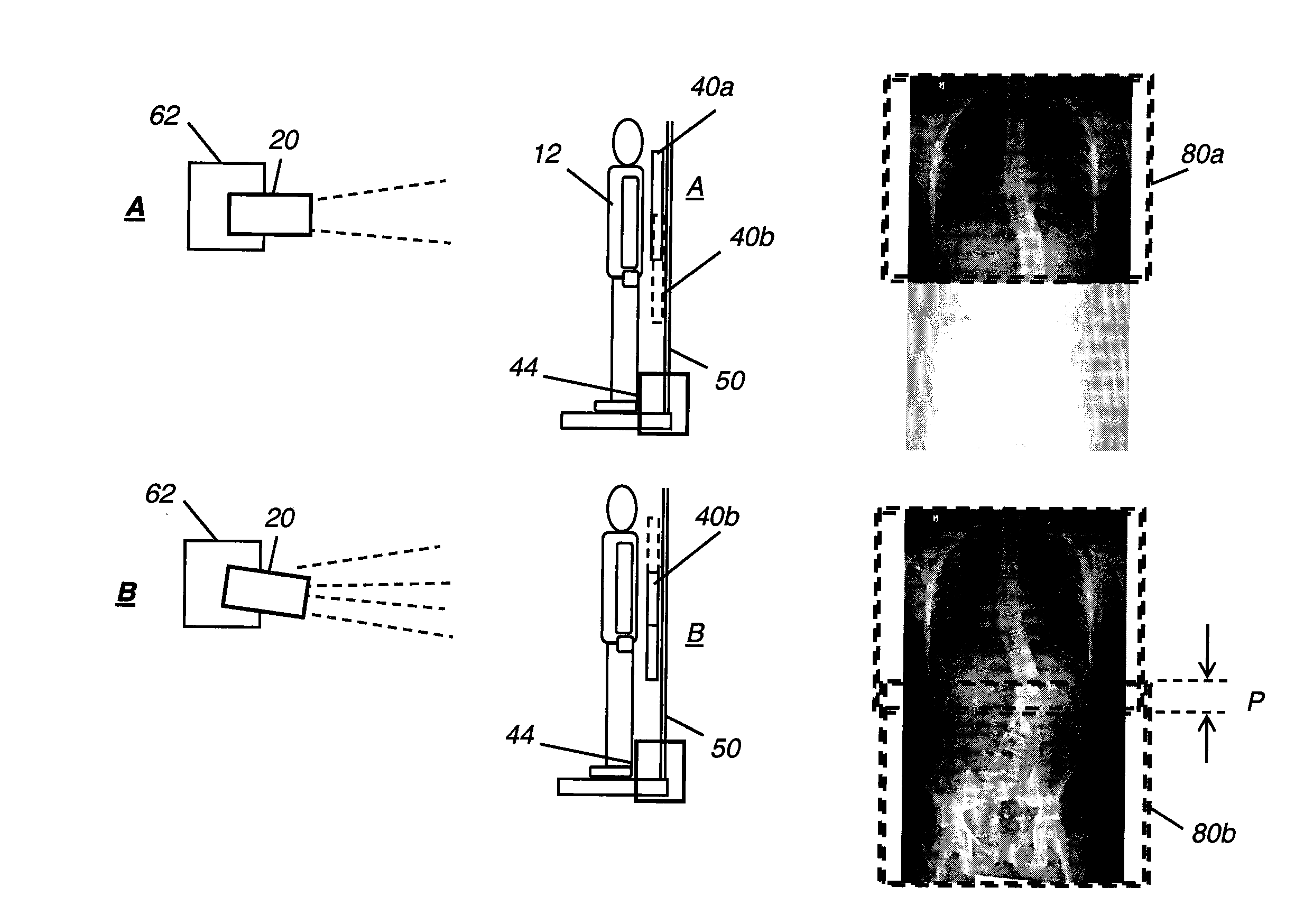 Long length multiple detector imaging apparatus and method
