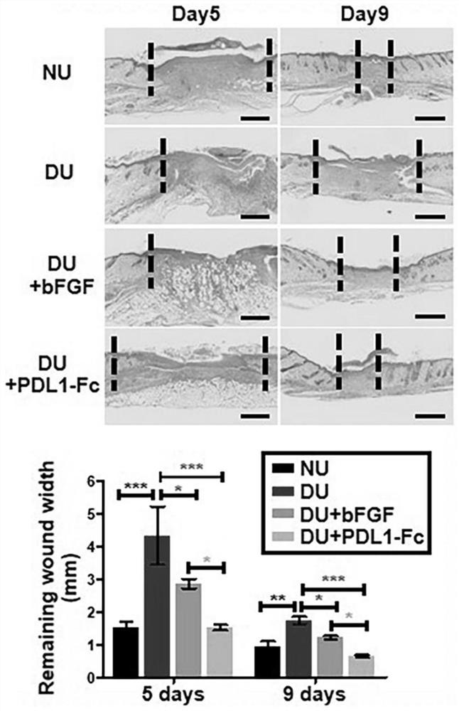 Application of eIF3I-PDL1-IRS4 axis in preparation of medicine for treating refractory ulcer