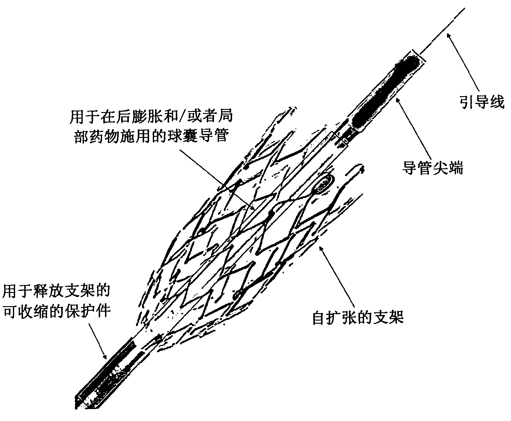 Controlled expansion balloon catheter