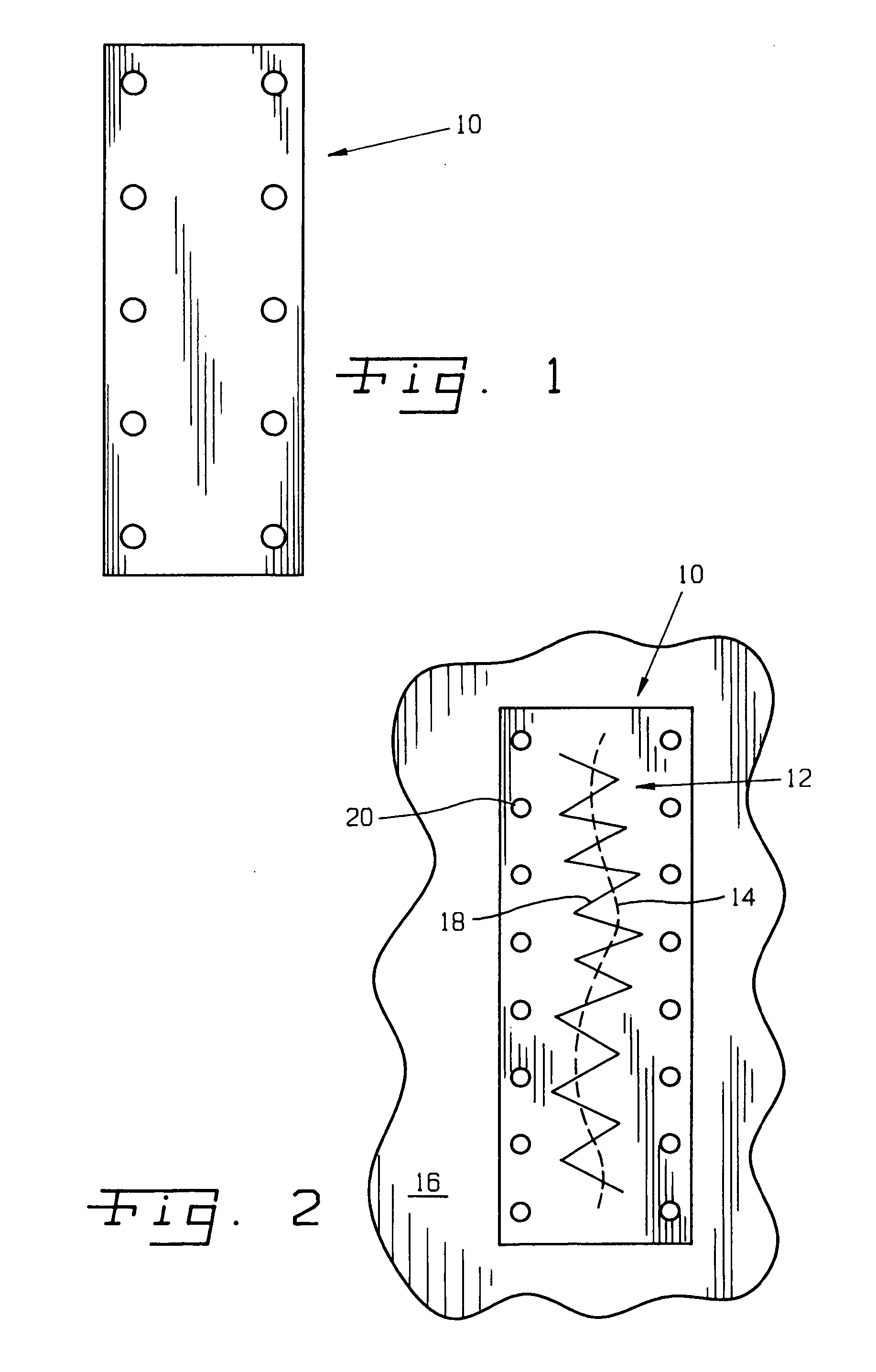 Surgical method and composition utilizing submucosal tissue to prevent incisional hernias