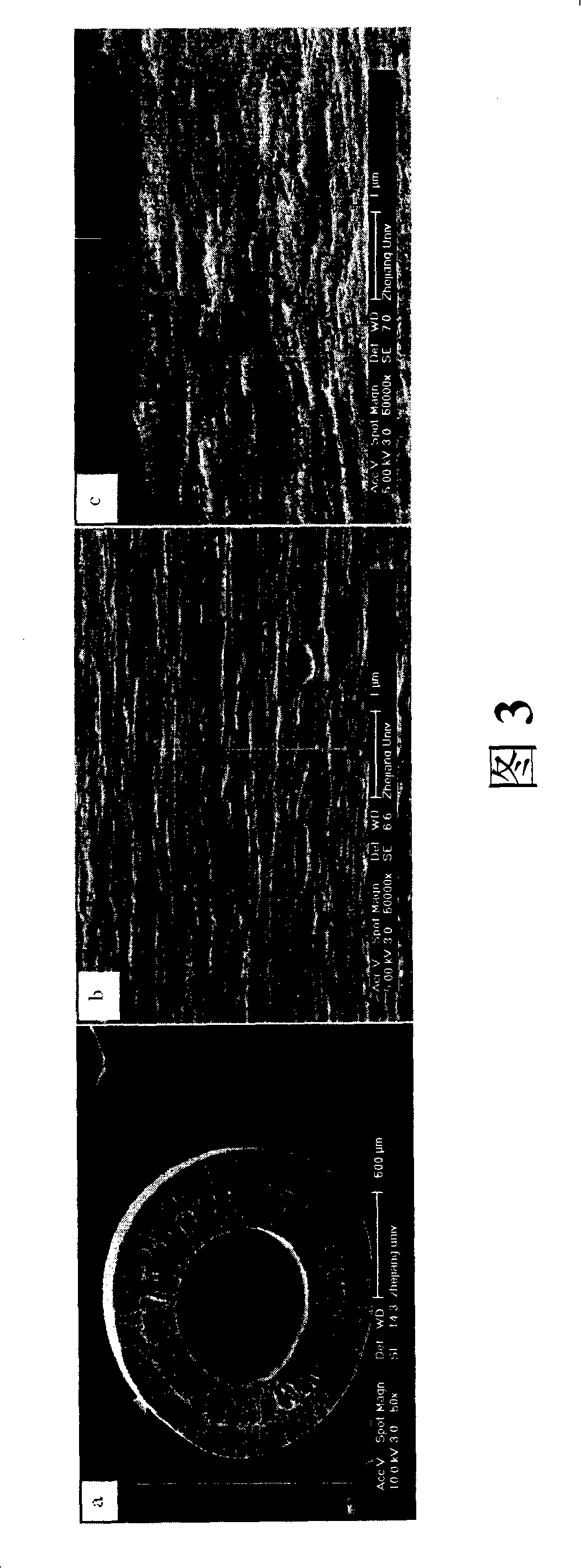 Hydrophilicity kynoar hollow fiber microporous membrane and preparation method thereof
