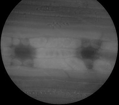 Pine needle sectioning observation method