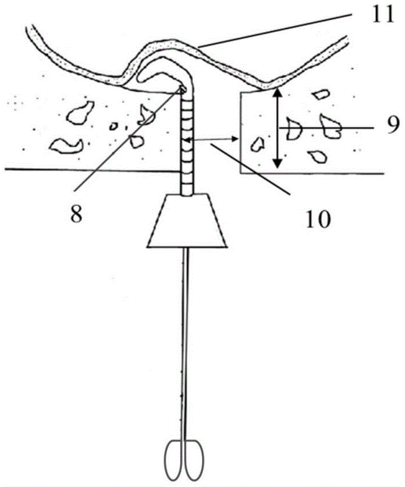 A Memory Elastic Silk Cannula for Stripping Maxillary Sinus Mucosa