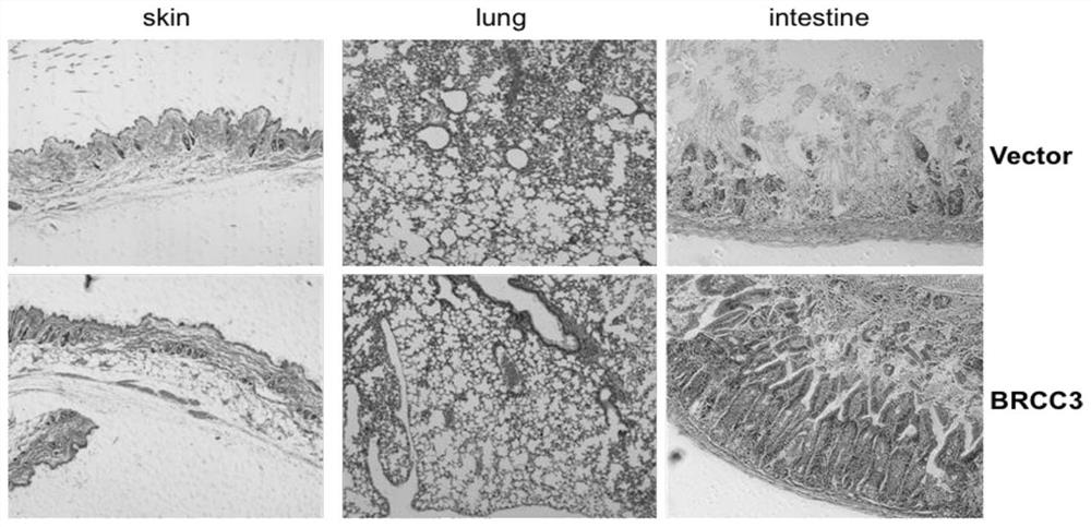 Application of deubiquitinating enzyme in preparation of medicine for preventing or treating acute graft versus host disease and graft anti-leukemia