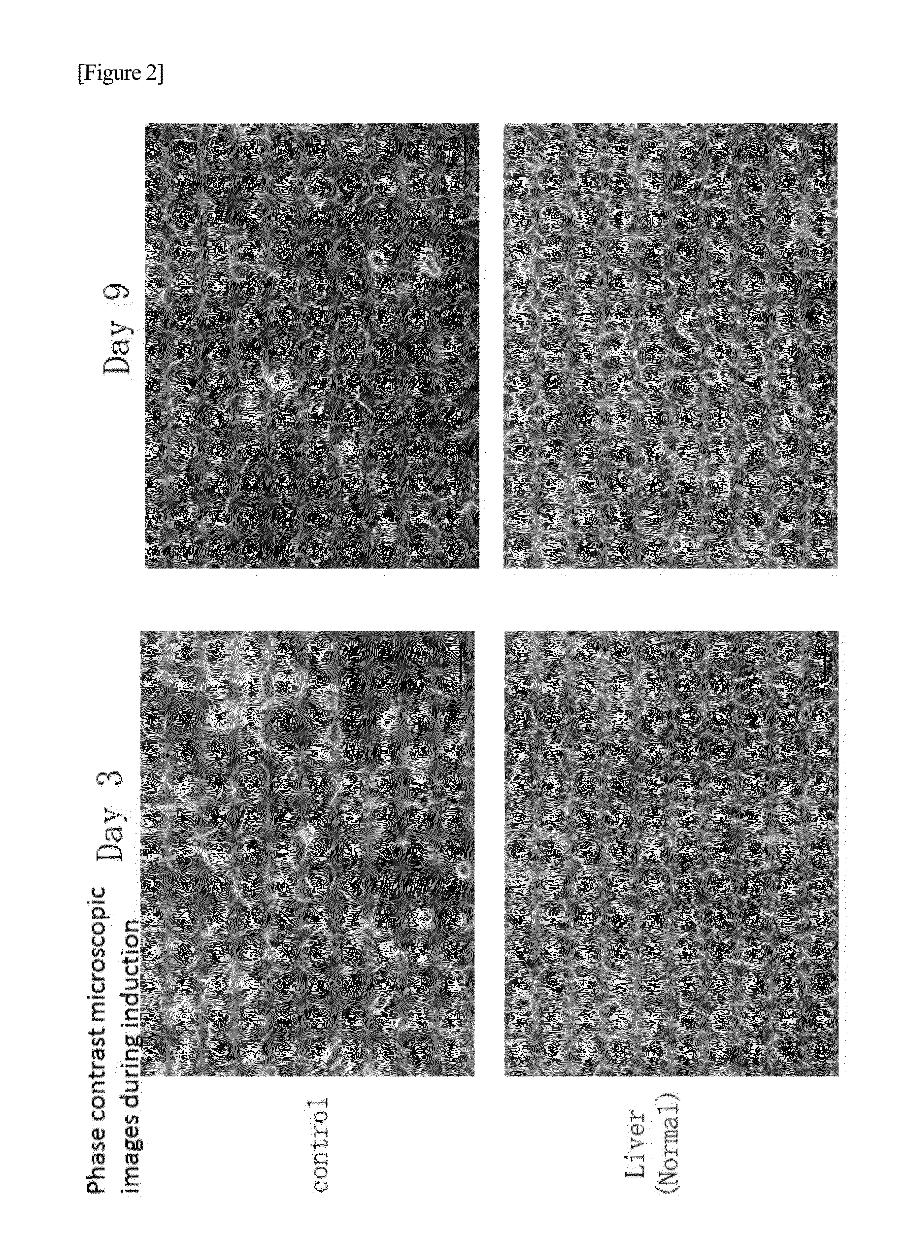 Method for inducing differentiation of induced pluripotent stem cells and method for selecting the same