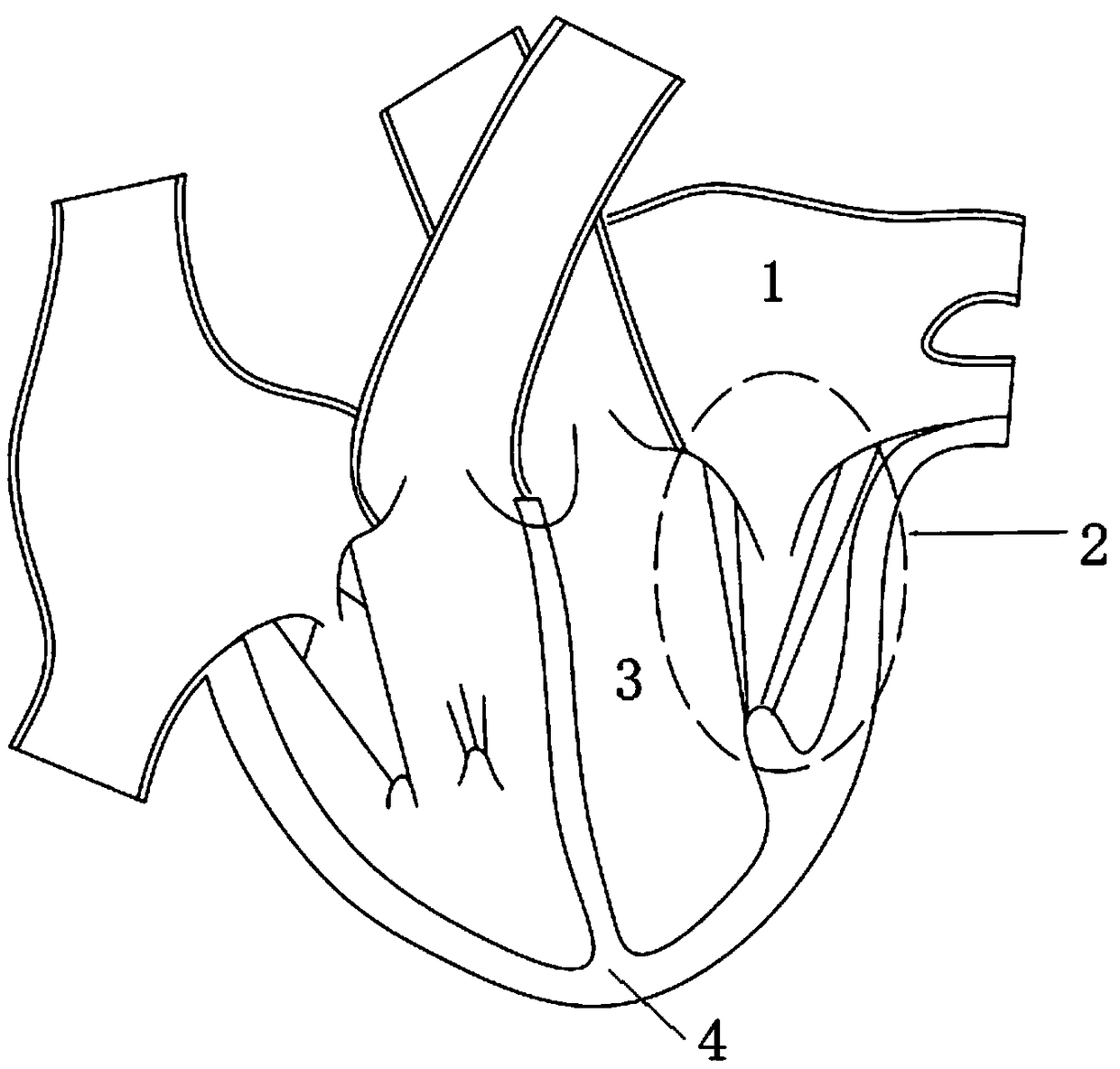 Instrument for placing mitral valve artificial tendinous cord