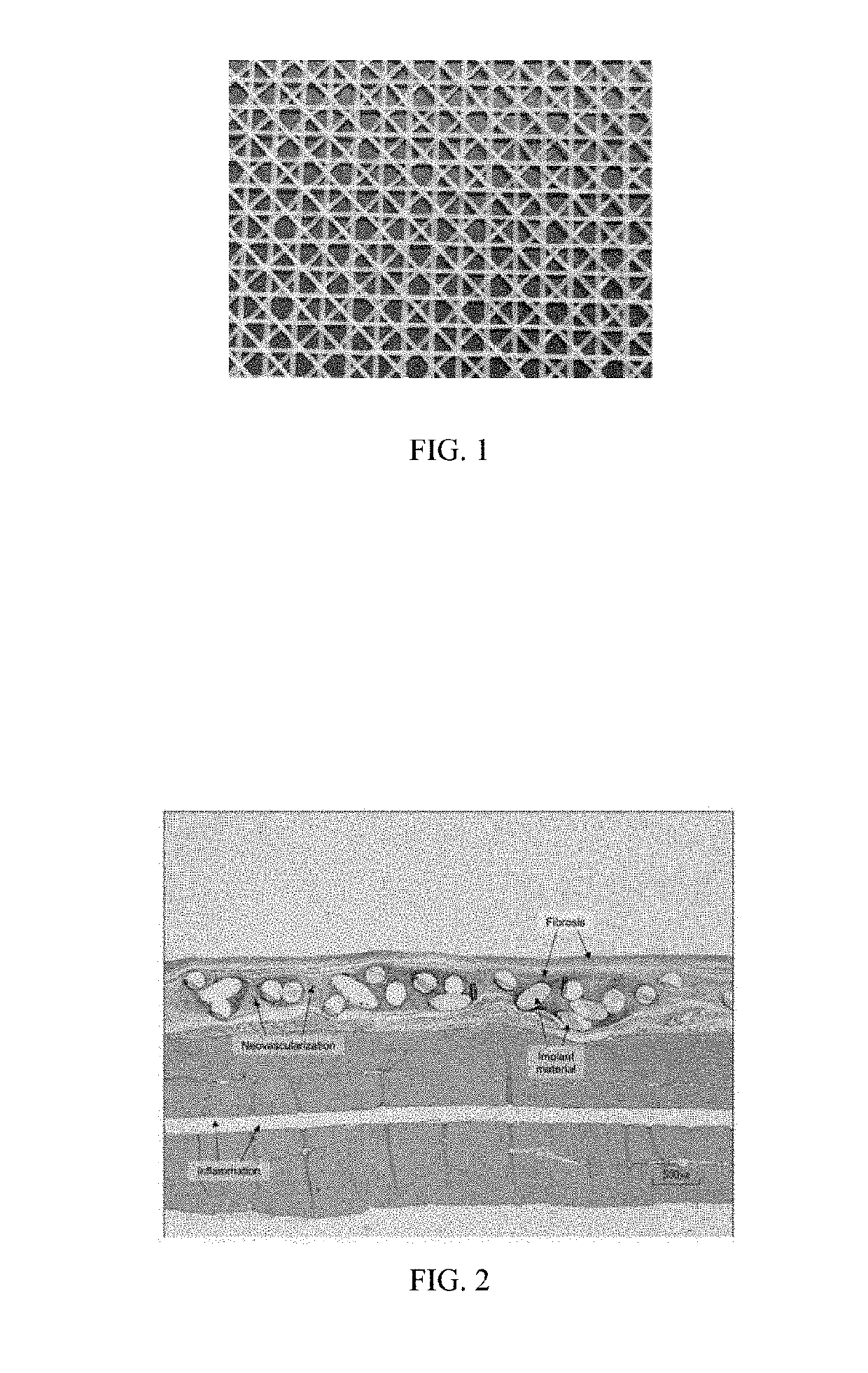 Hernia repair, breast reconstruction and sling devices containing poly(butylene succinate) and copolymers thereof