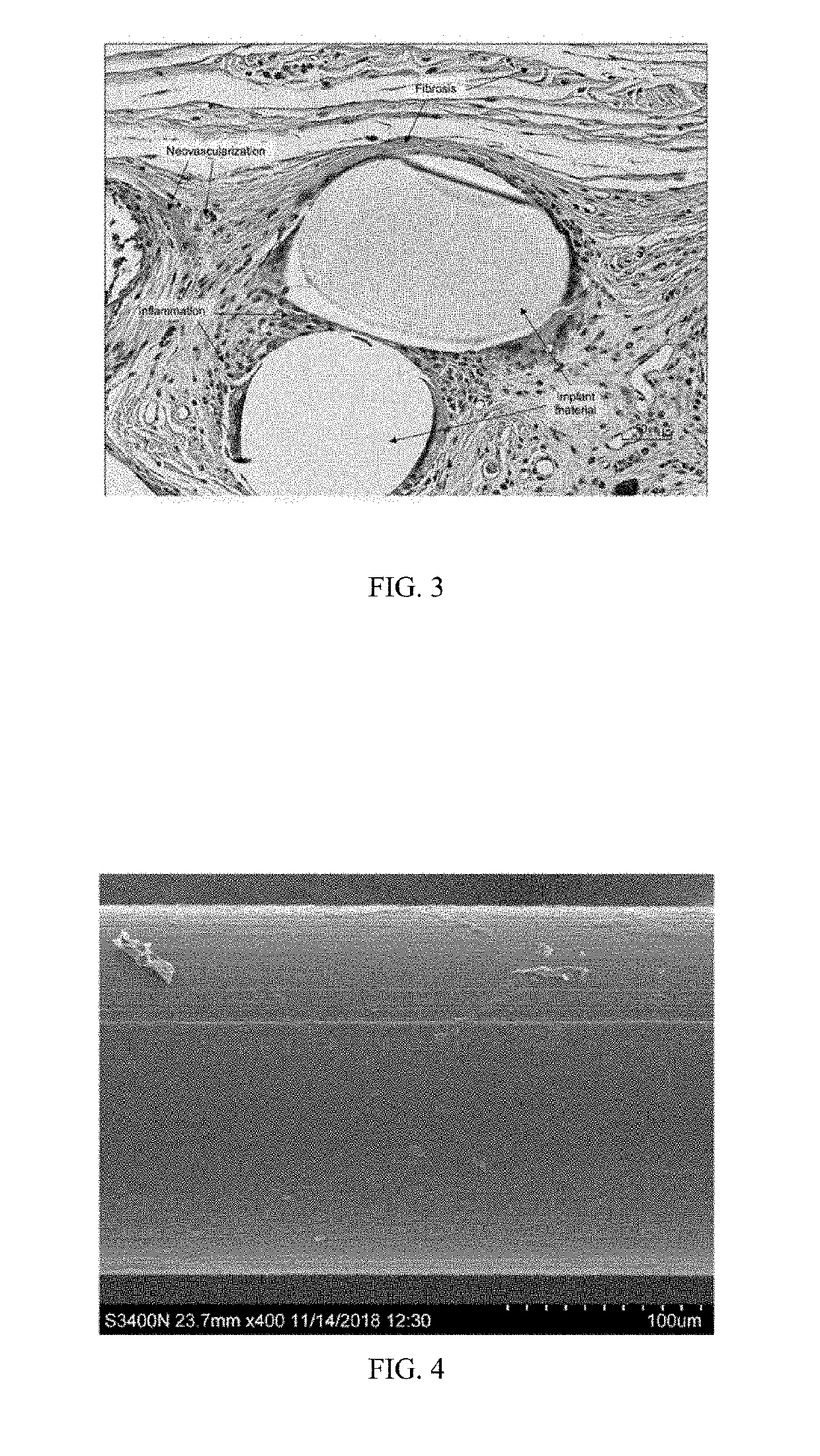 Hernia repair, breast reconstruction and sling devices containing poly(butylene succinate) and copolymers thereof