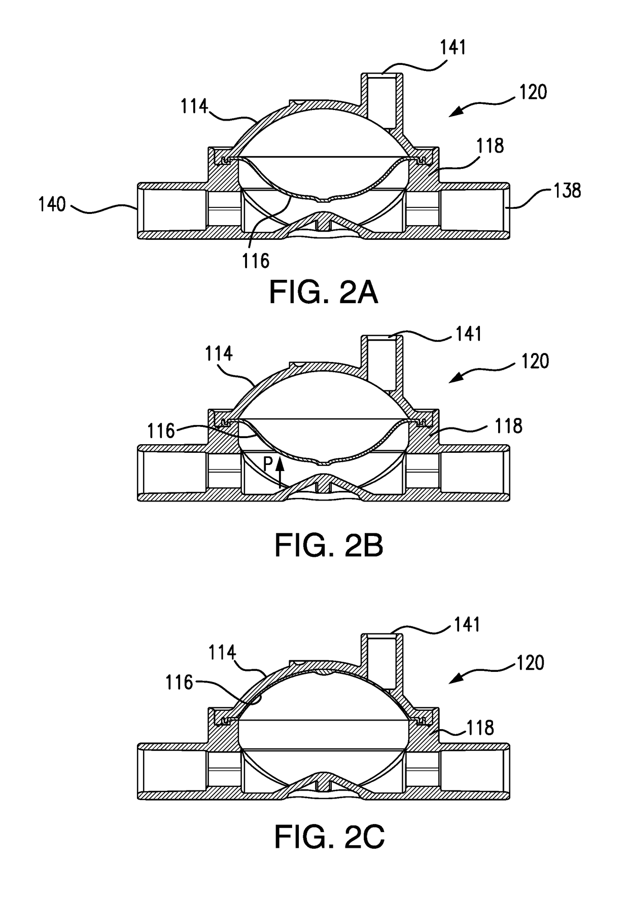 Pressure Output Device For Extracorporeal Hemodialysis Machine