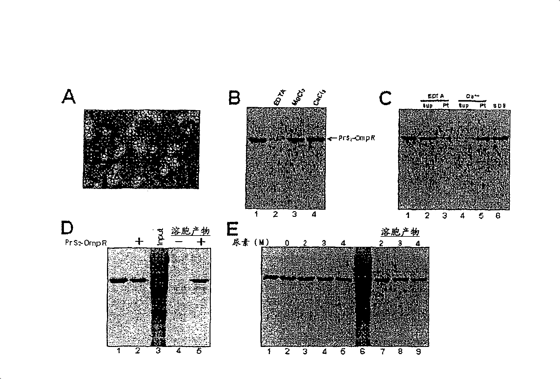 The use of protein S fusion for protein solubilization