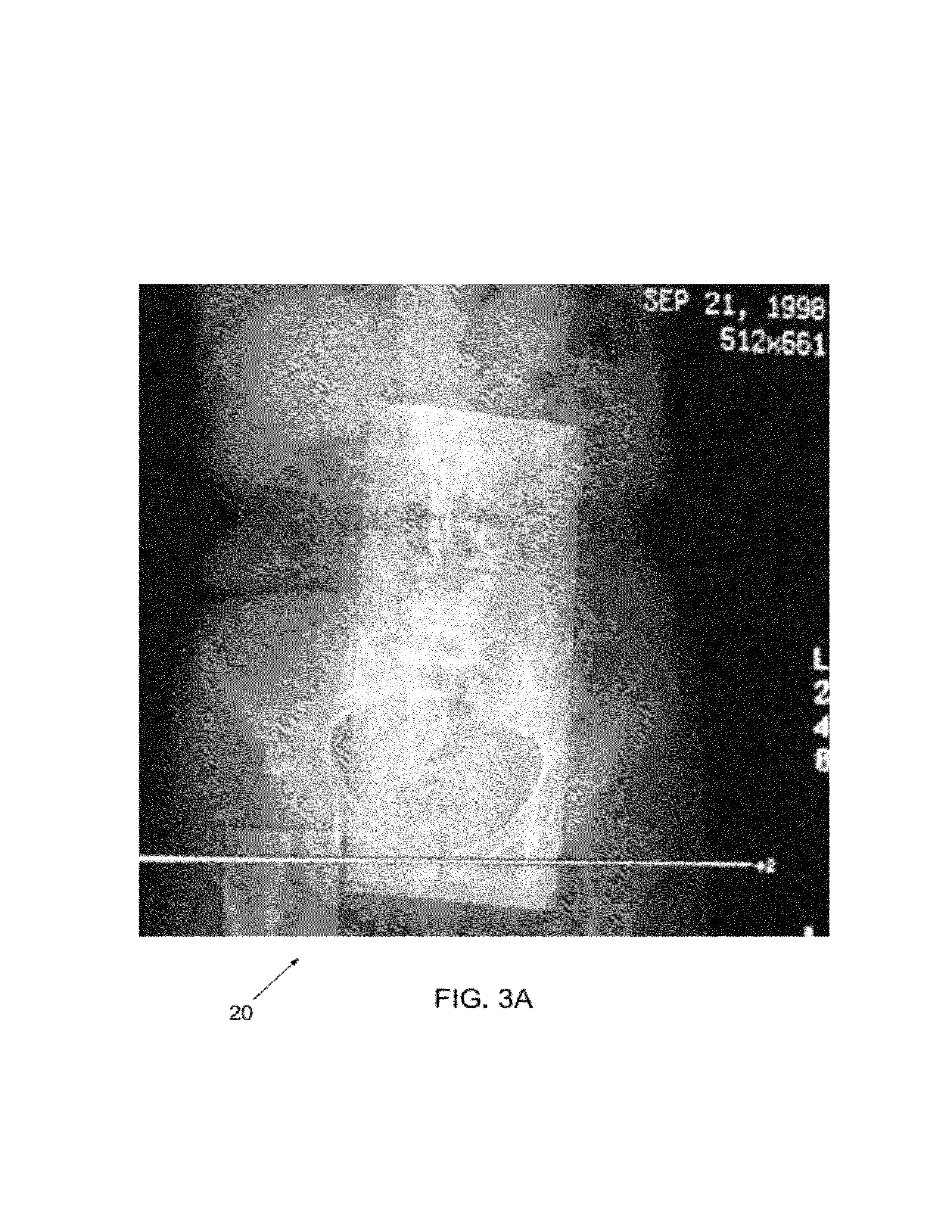 Extended and fixed INTable simultaneously imaged calibration and correction methods and references for 3-D imaging devices