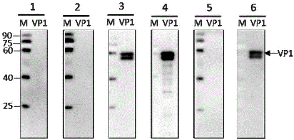 Preparation and application of mouse monoclonal antibody against noroviruses GII.4