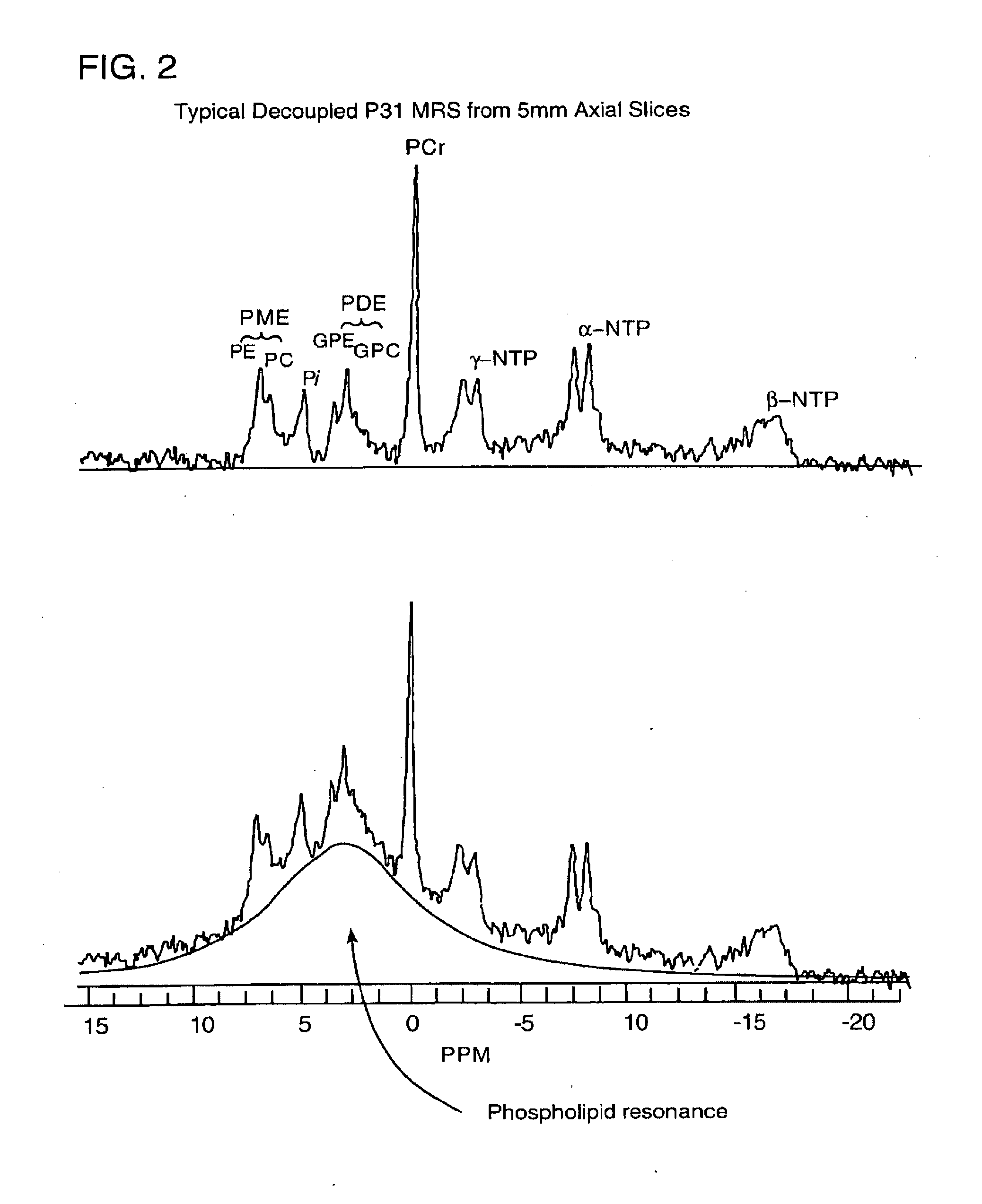 Methods of treating psychiatric, substance abuse, and other disorders using combinations containing omega-3 fatty acids