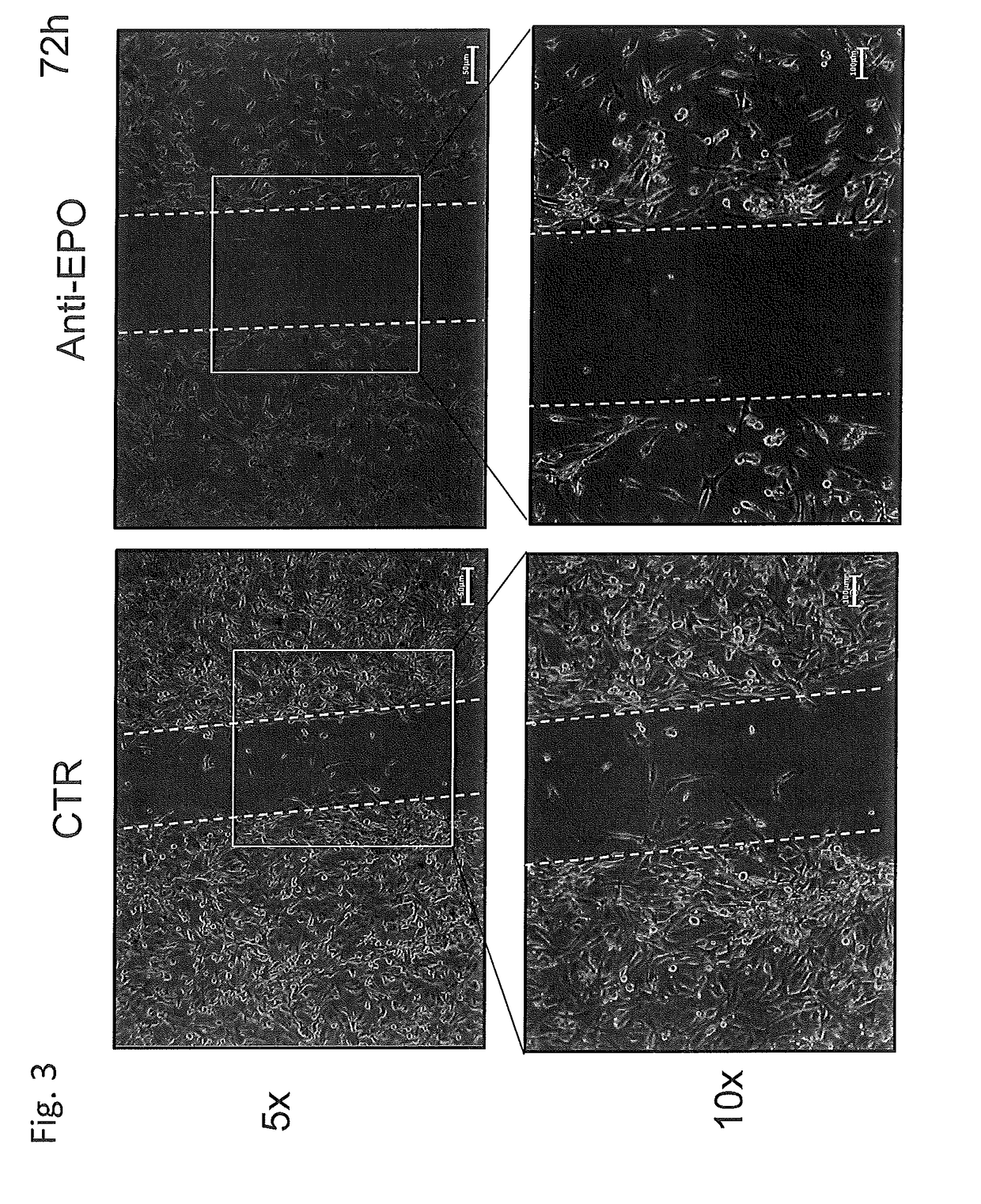 Use of negative functional modulators of erythropoietin for therapy