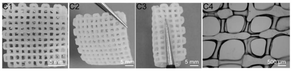 3D printing hydrogel for treating or preventing intrauterine adhesion and preparation method of hydrogel