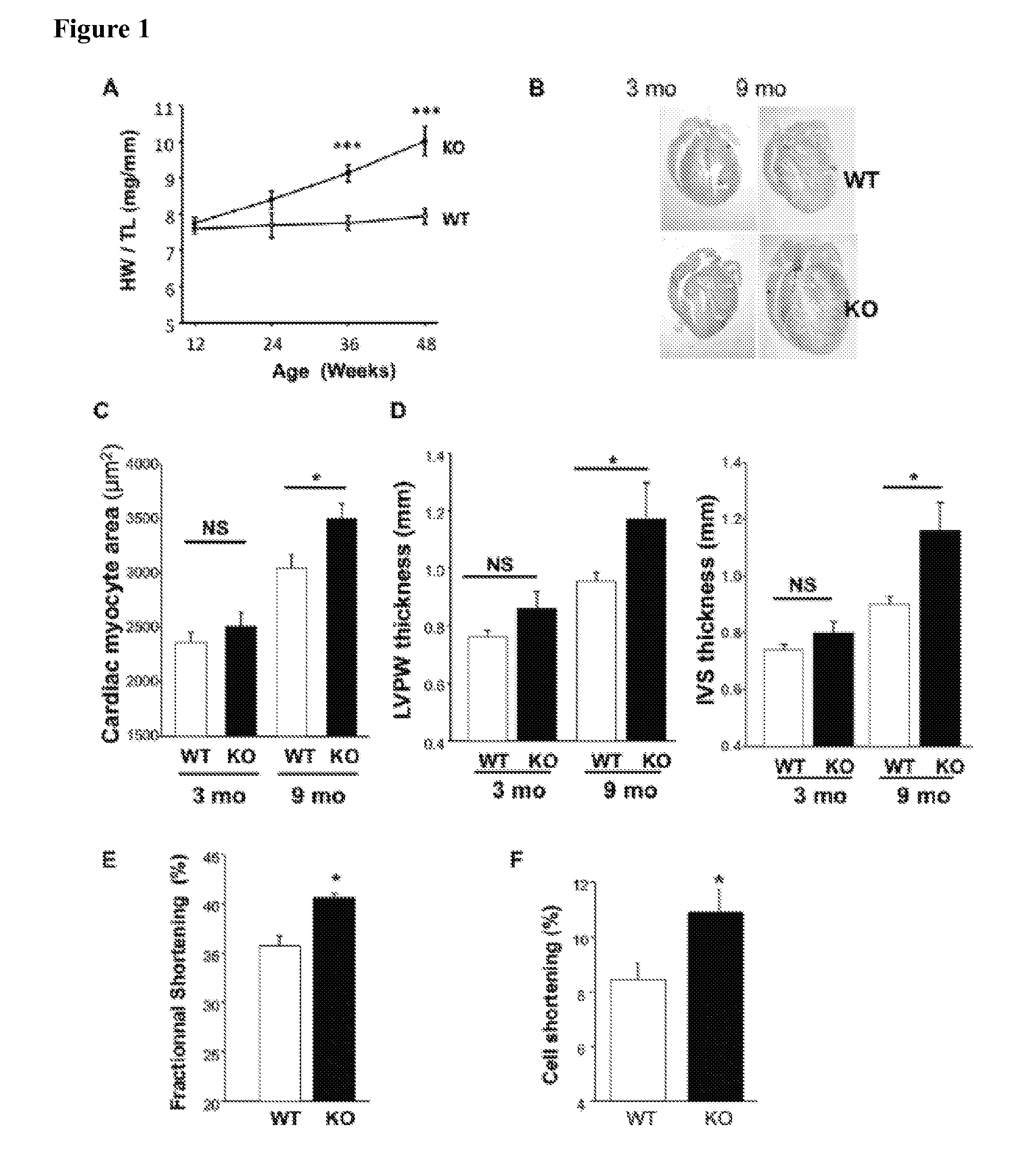 Inhibitors of MRP4 and agents stimulating MRP4 activity for the treatment of cardiac disorders