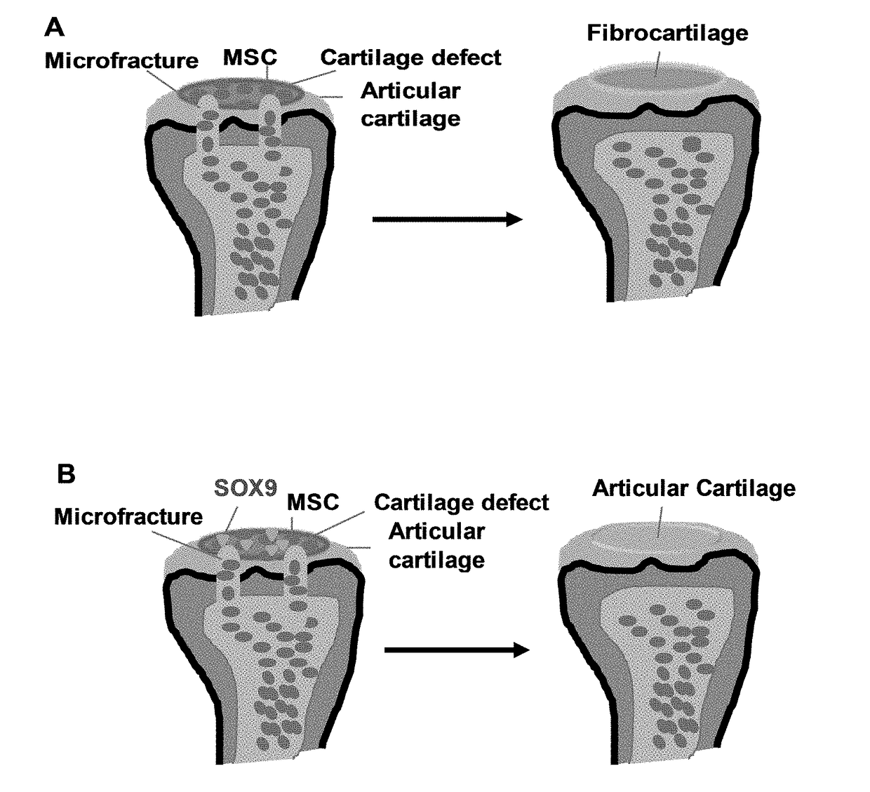 Methods for repairing cartilage damage