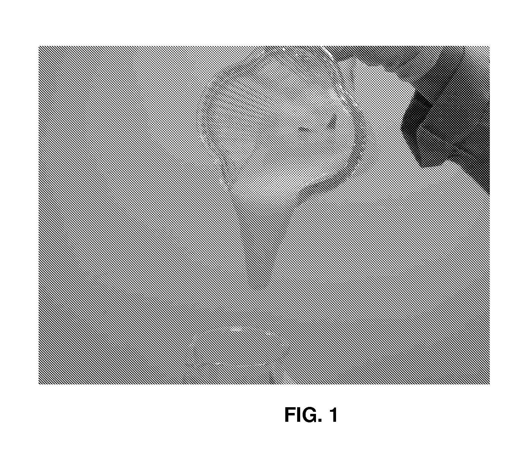 Organic acid treating fluids with viscoelastic surfactants and internal breakers