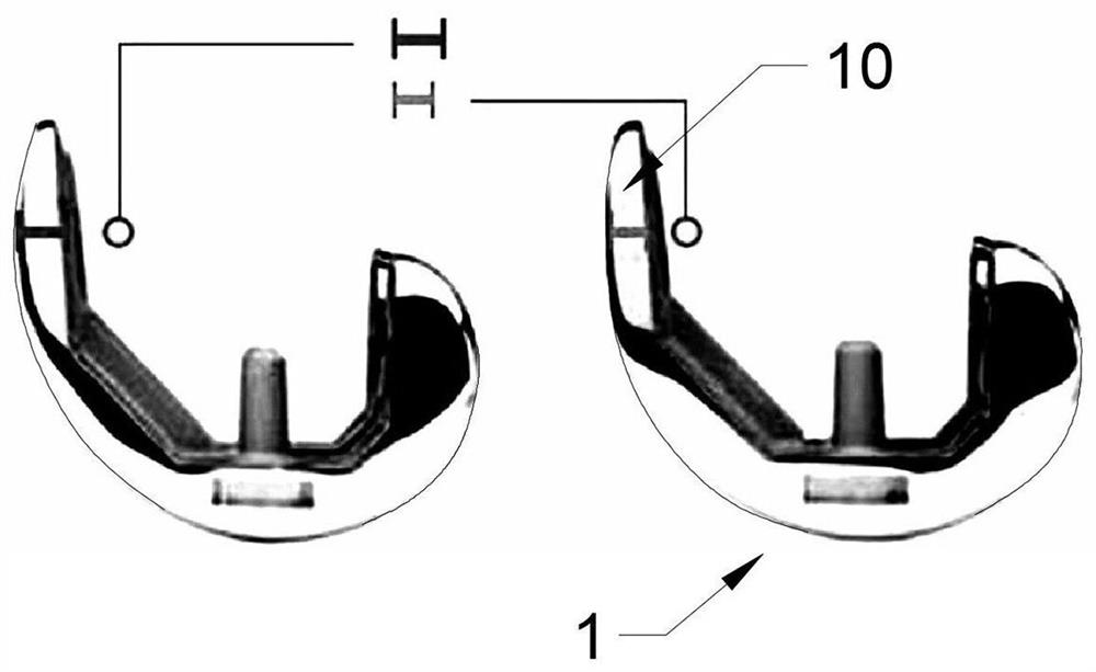 Female knee joint prosthesis and design method thereof