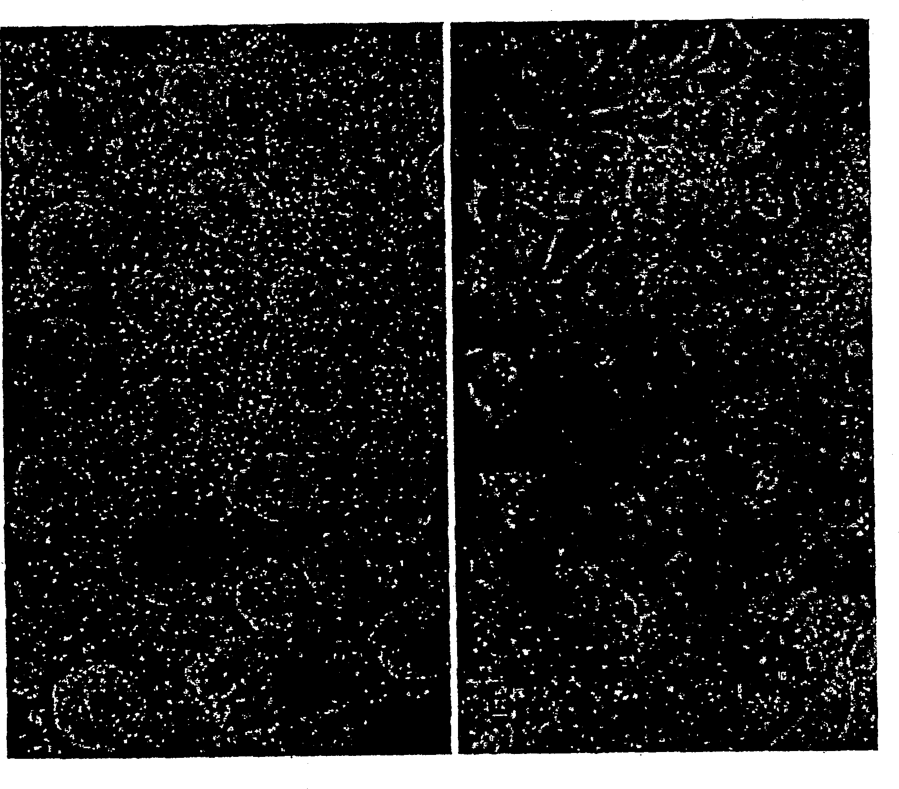 Human pancreatic epithelial progenitor cells and methods of isolation and use thereof