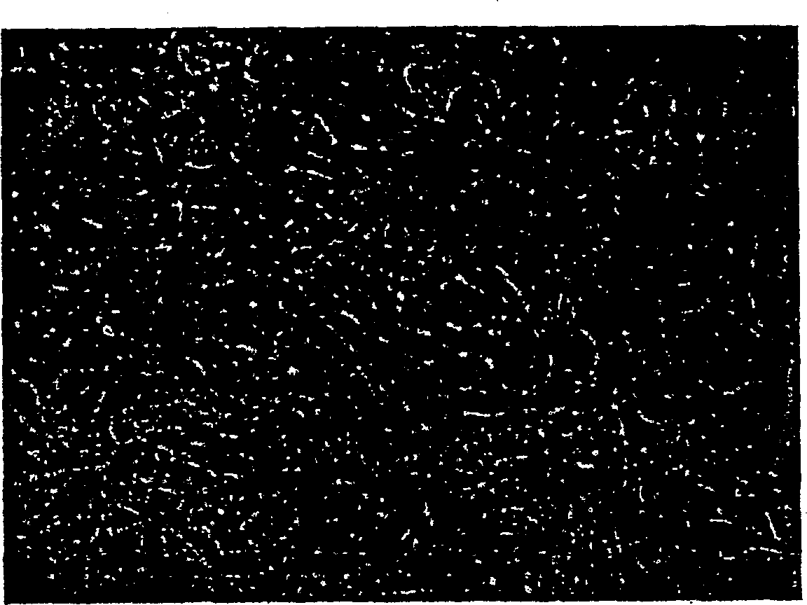 Human pancreatic epithelial progenitor cells and methods of isolation and use thereof