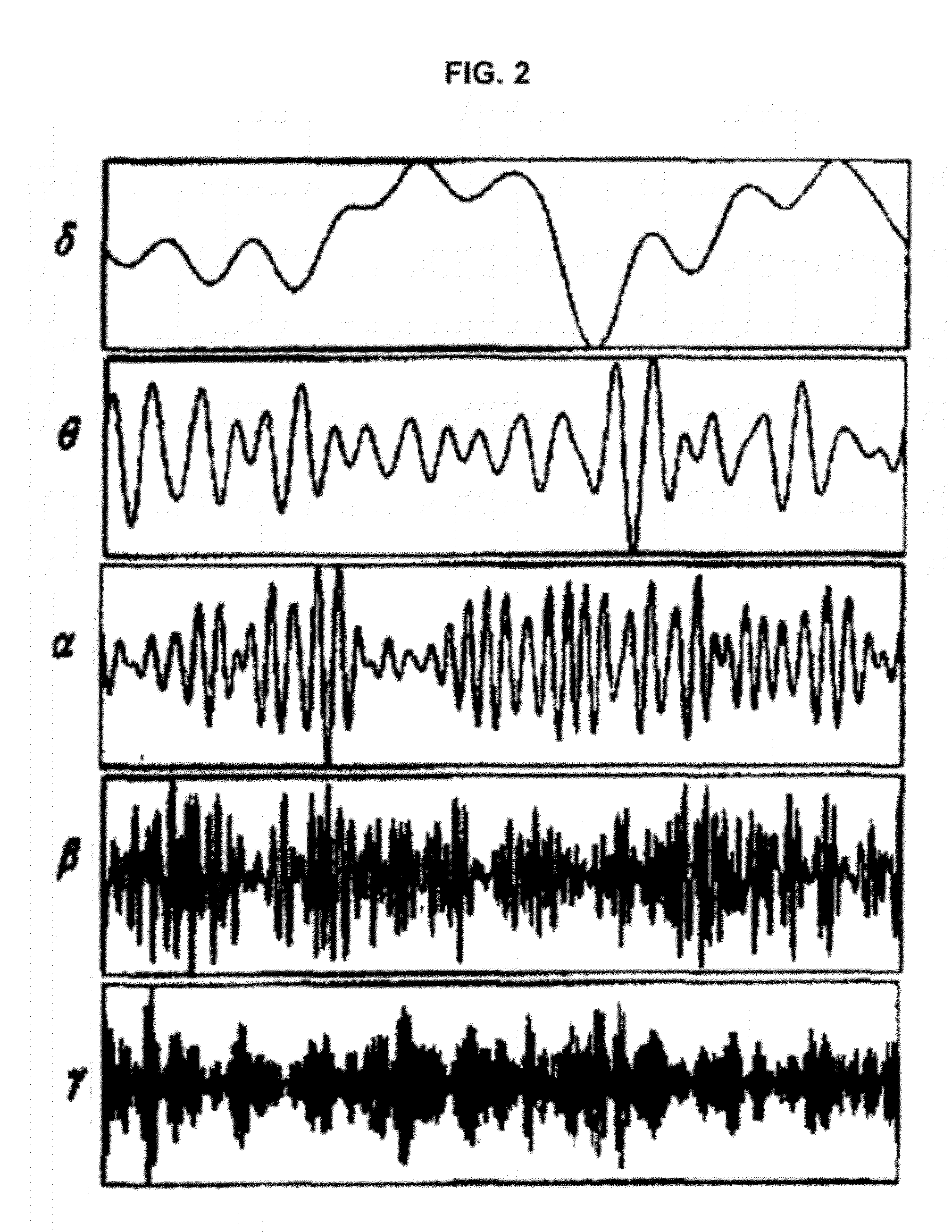 Readiness potential-based brain-computer interface device and method
