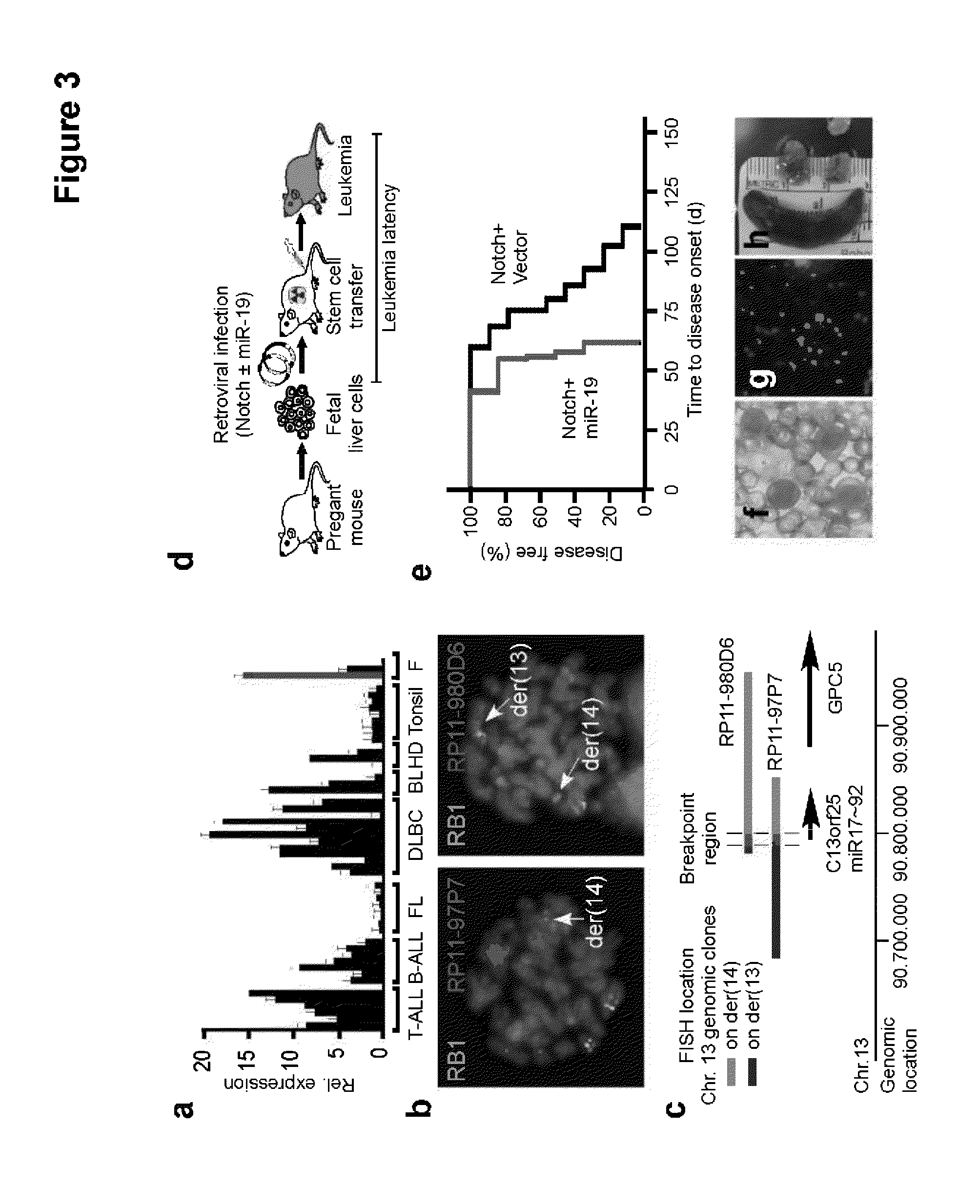 Methods and Compositions for the Detection and Treatment of Cancer involving miRNAs and miRNA Inhibitors and Targets