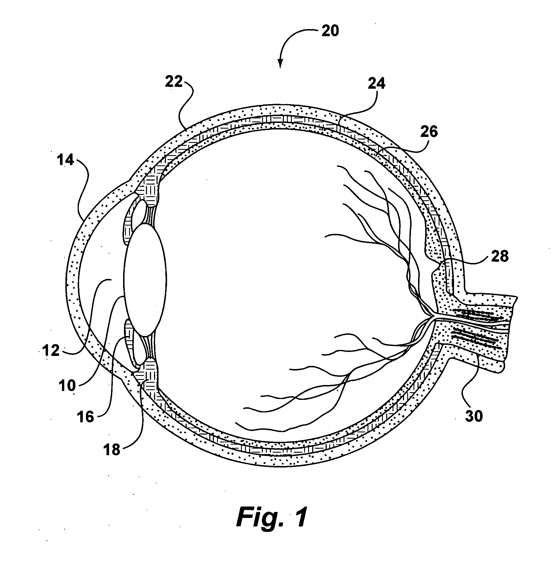 System and method for storing, shipping and injecting ocular devices