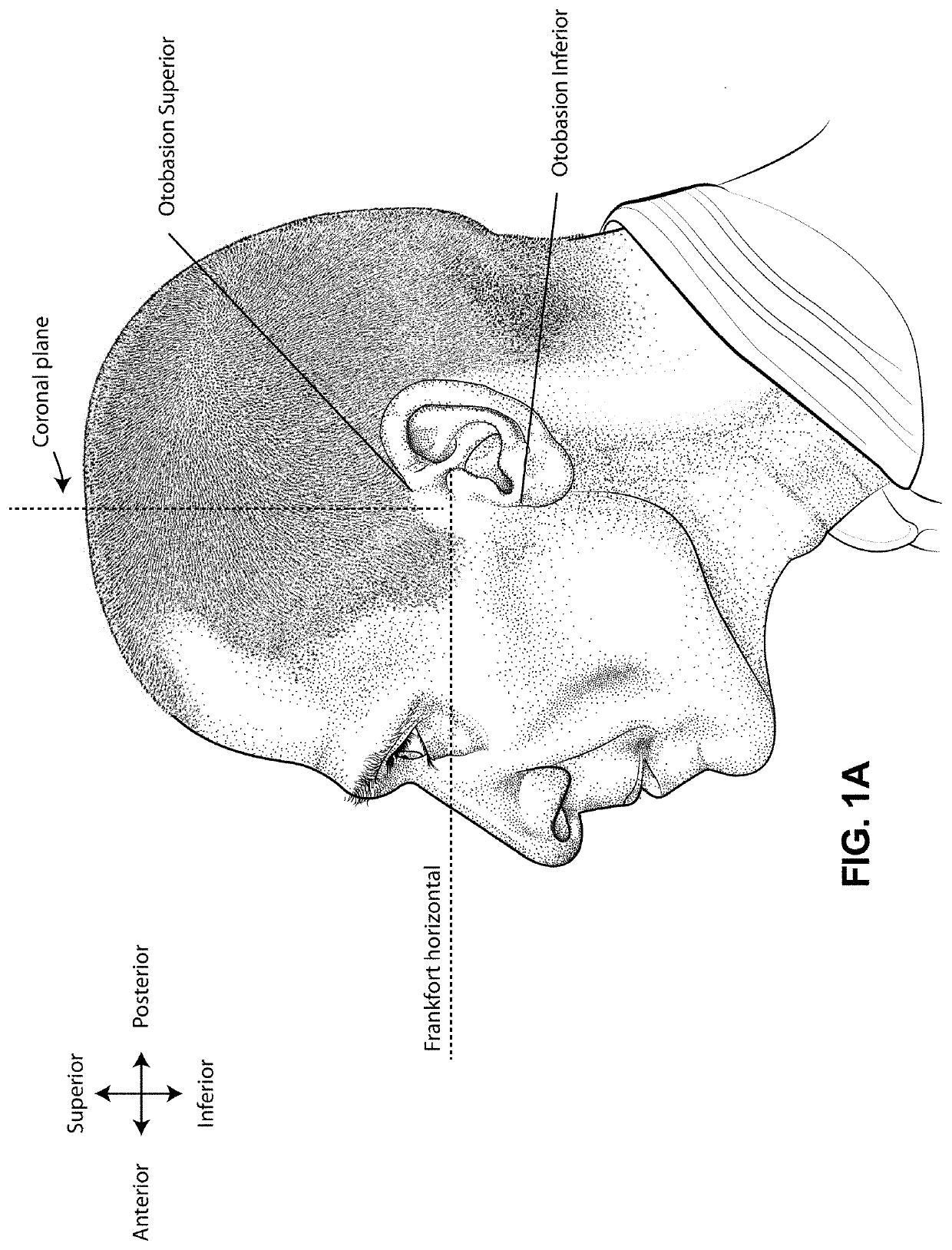 Positioning and stabilising structure and system incorporating same