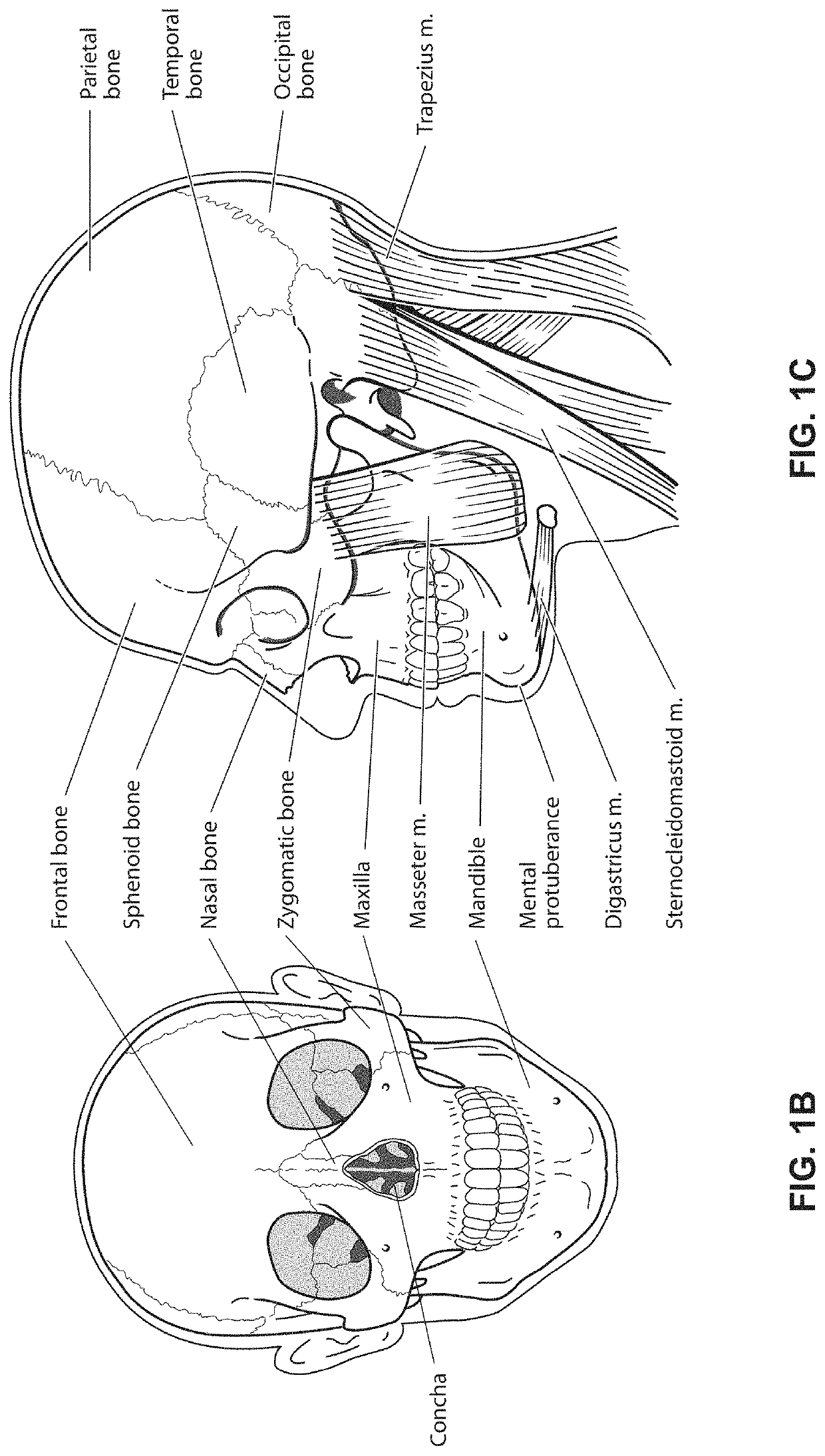 Positioning and stabilising structure and system incorporating same