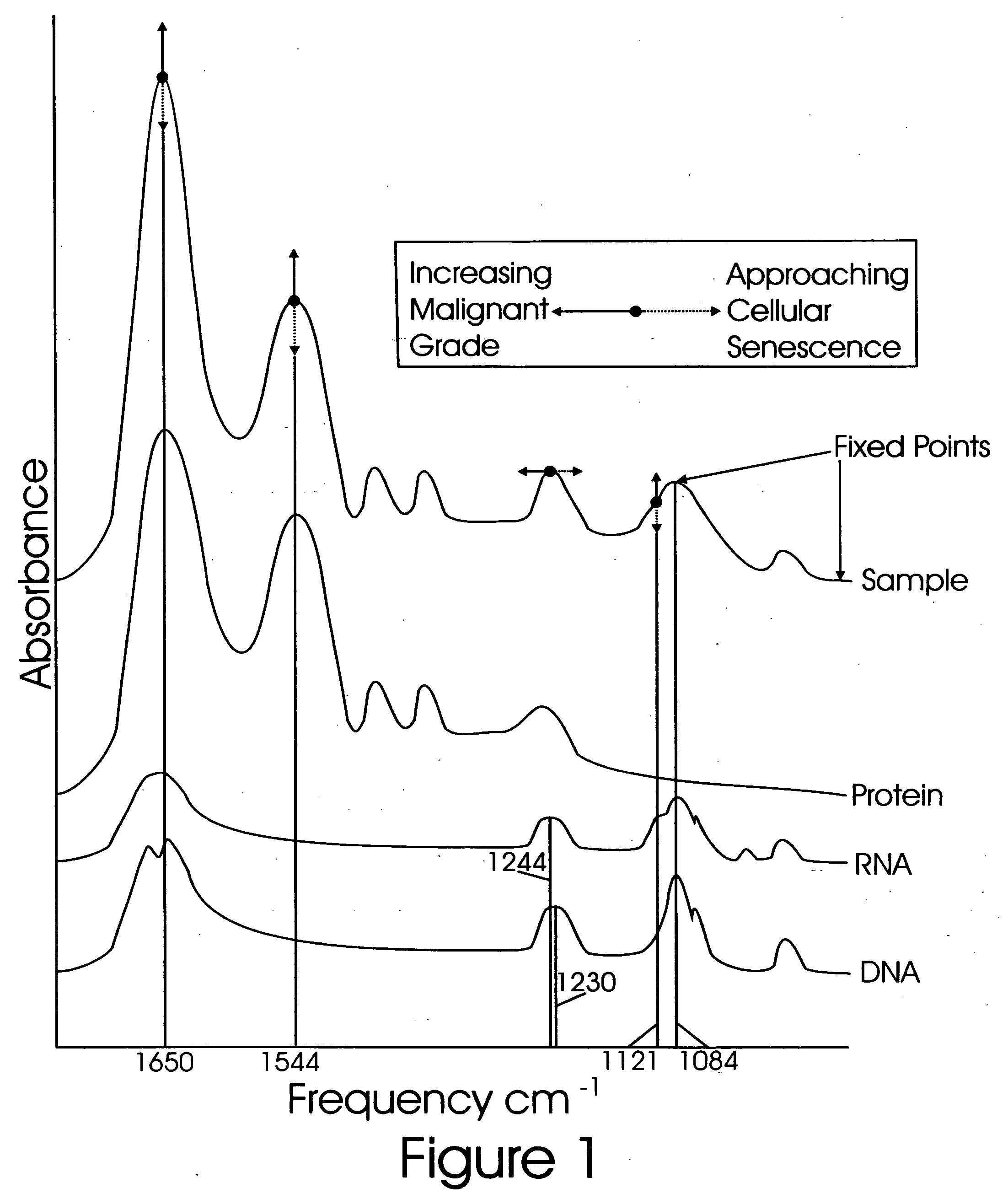 Method of grading disease by Fourier Transform Infrared Spectroscopy