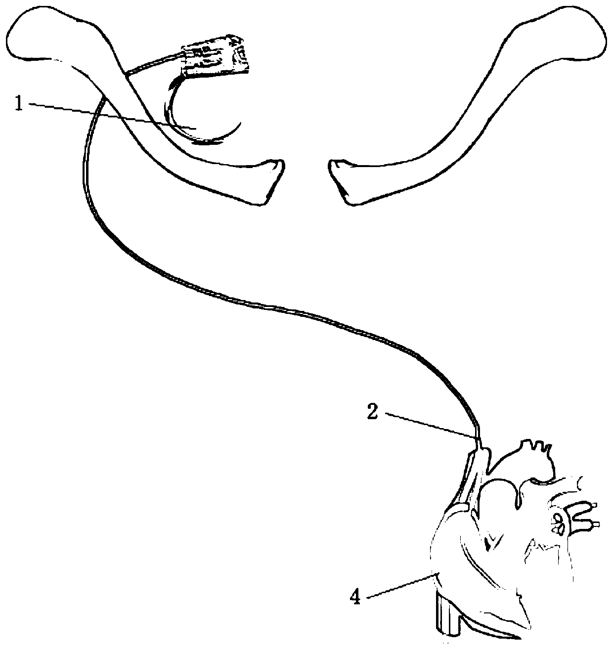 Heart failure animal model for implanting pacemaker through external jugular vein under guidance of B-mode ultrasound