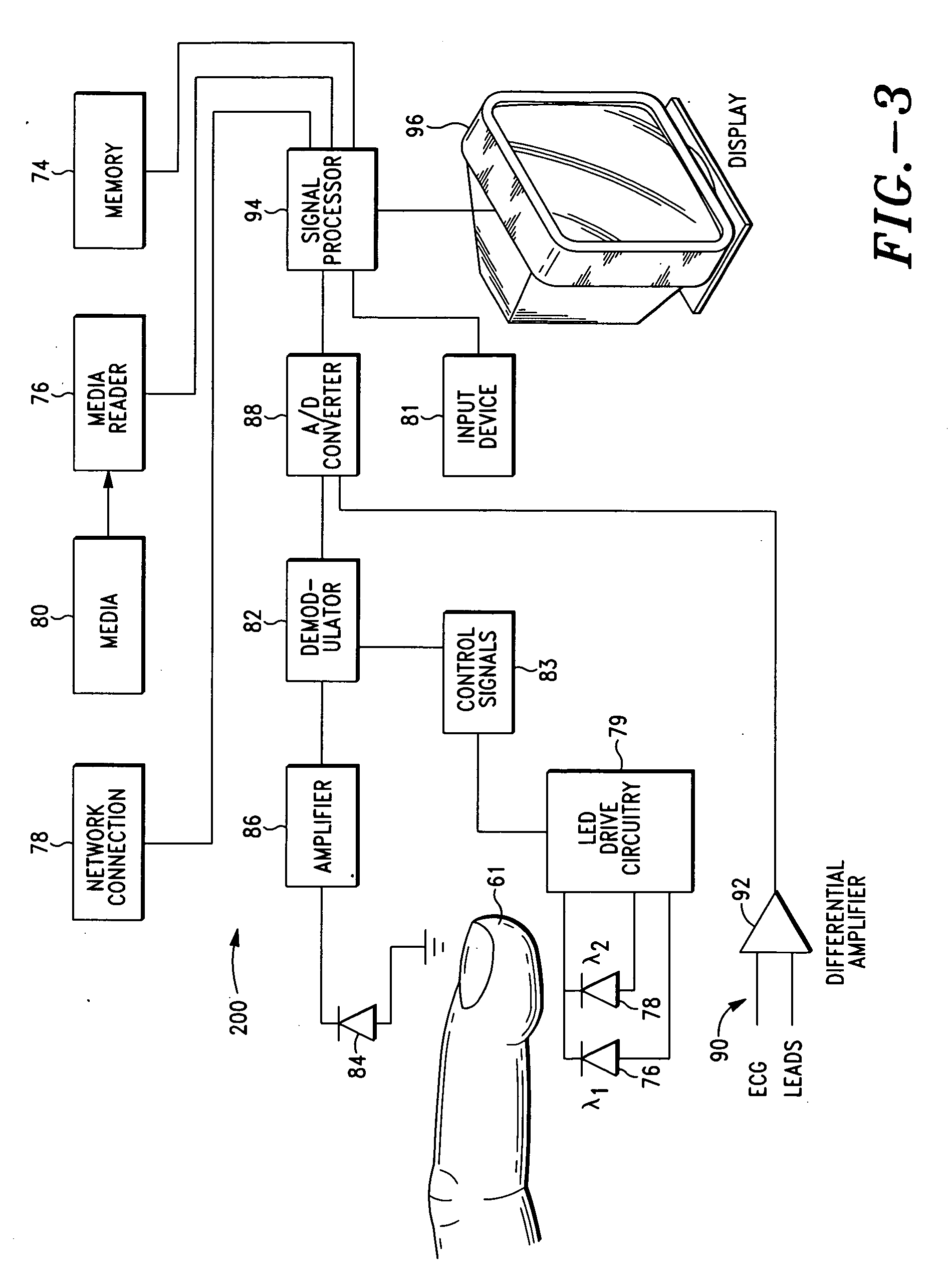 Method and system for determining cardiac function