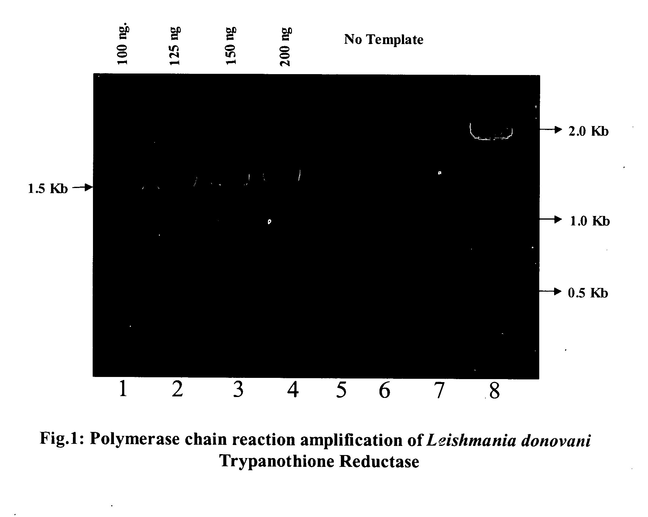Heterologus expression of trypanothione reductase from Leishmania donovani in a prokaryotic system