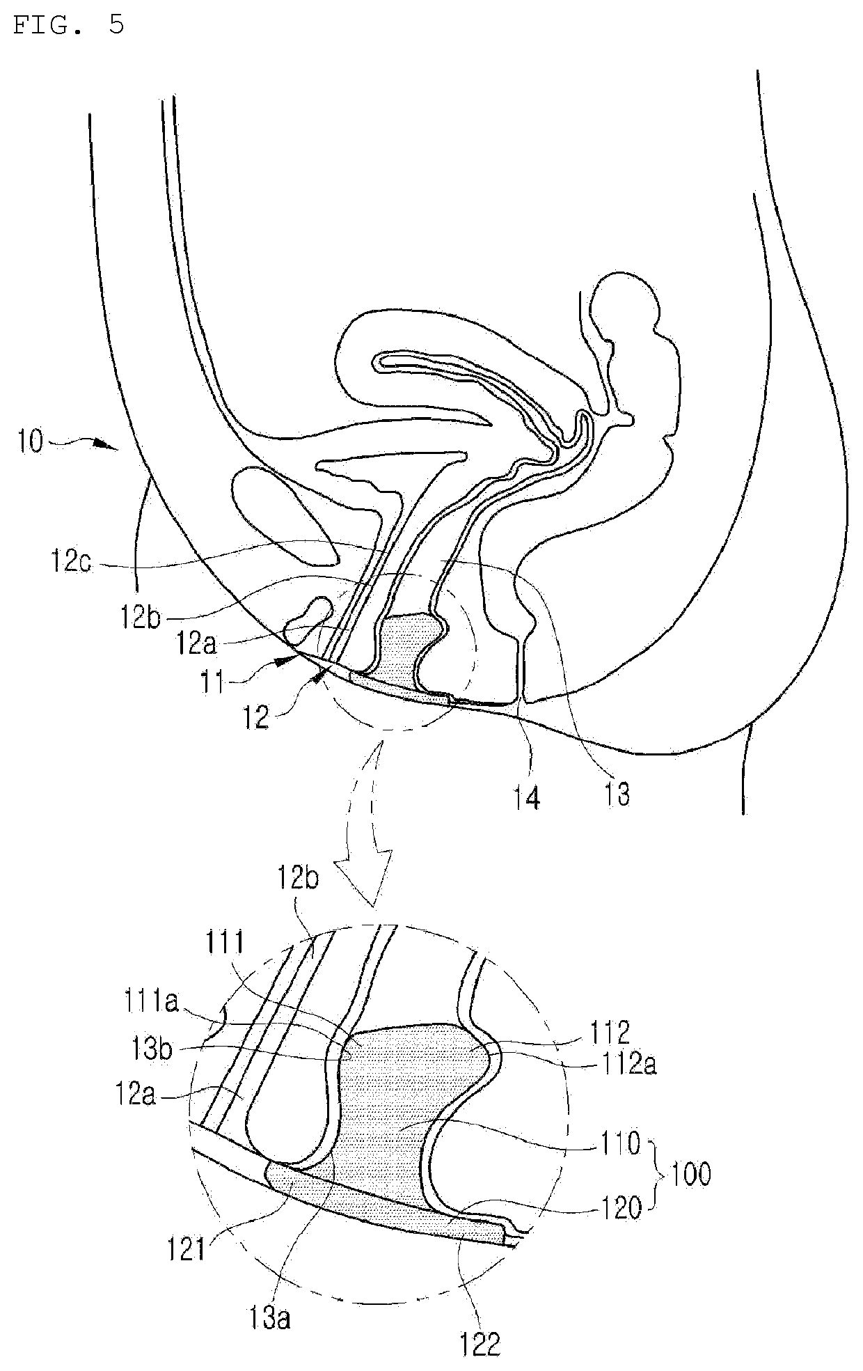 Apparatus for Treating Urinary Incontinence, and Panties Having Same