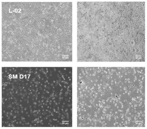 Method for inducing differentiation of human adipose derived stromal cells into liver cells through micromolecules