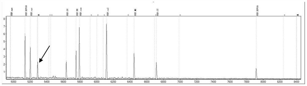 Preparation method of nucleic acid fingerprint database for detecting genital tract pathogens by MALDI TOF-MS (matrix-assisted laser desorption/ionization time-of-flight mass spectrometry)