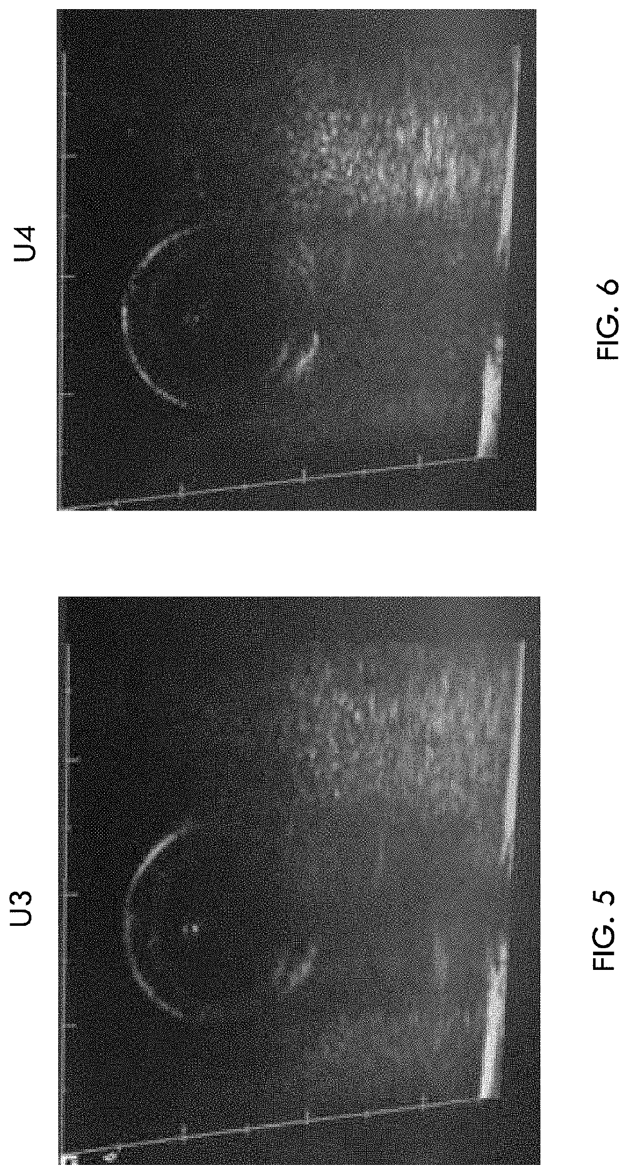 Repositionable medical tube with ultrasonically-detectable cuff