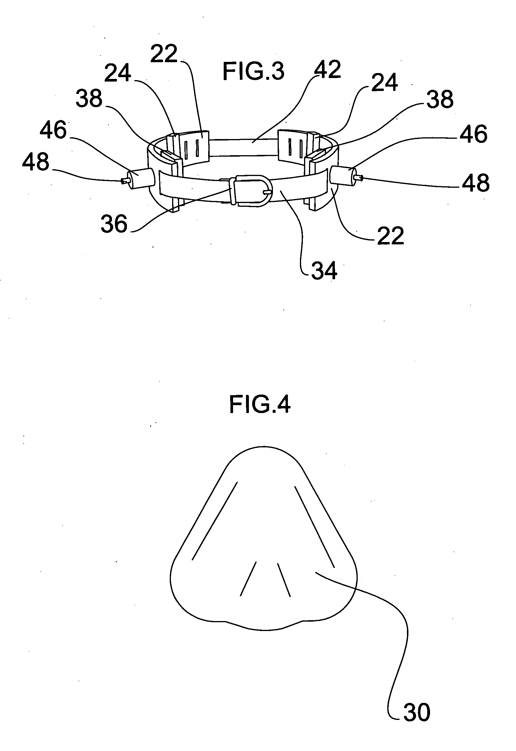 Method and apparatus for nonsurgical correction of chest wall deformities