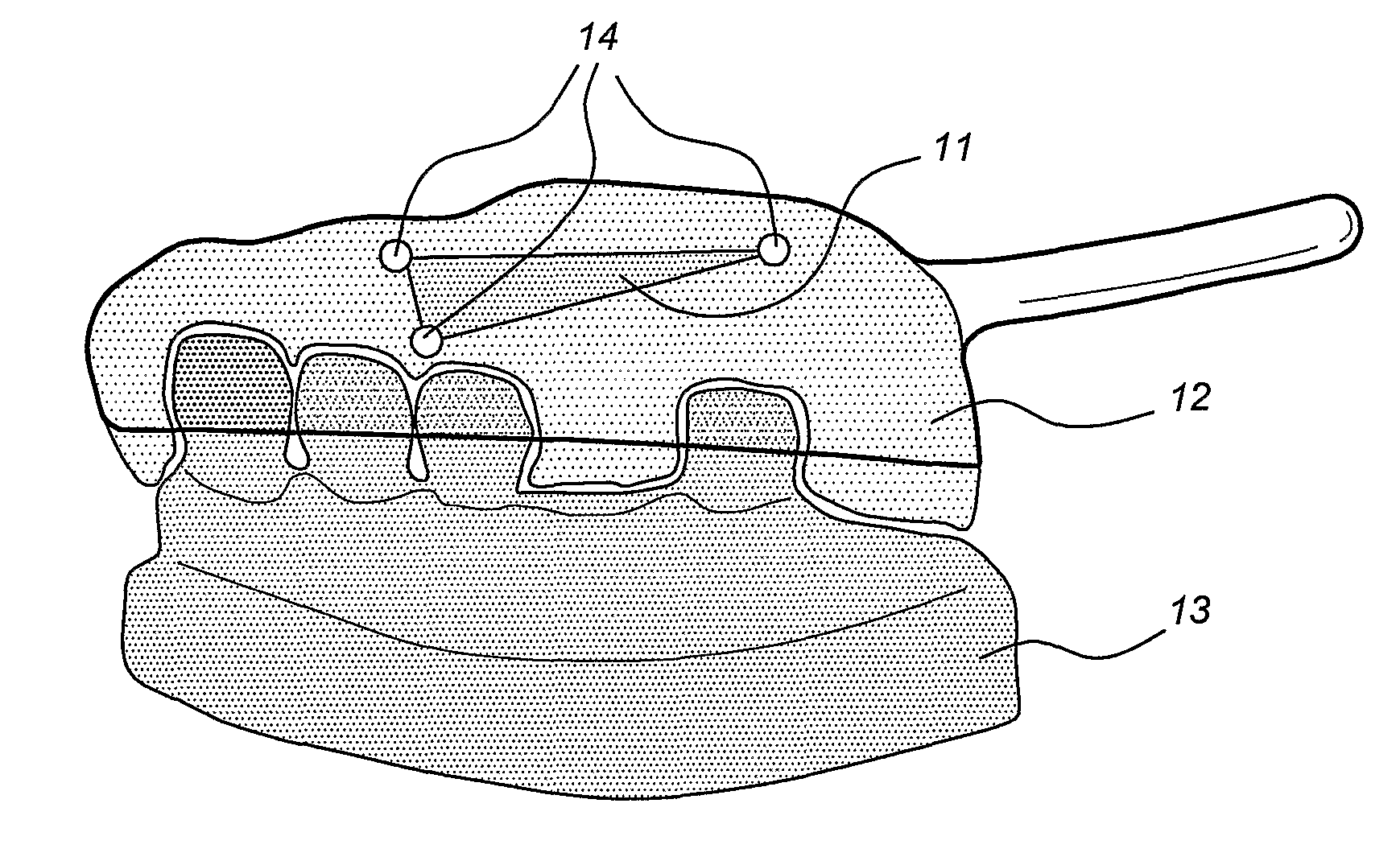 Method of Manufacturing and Installing a Ceramic Dental Implant with an Aesthetic Implant Abutment