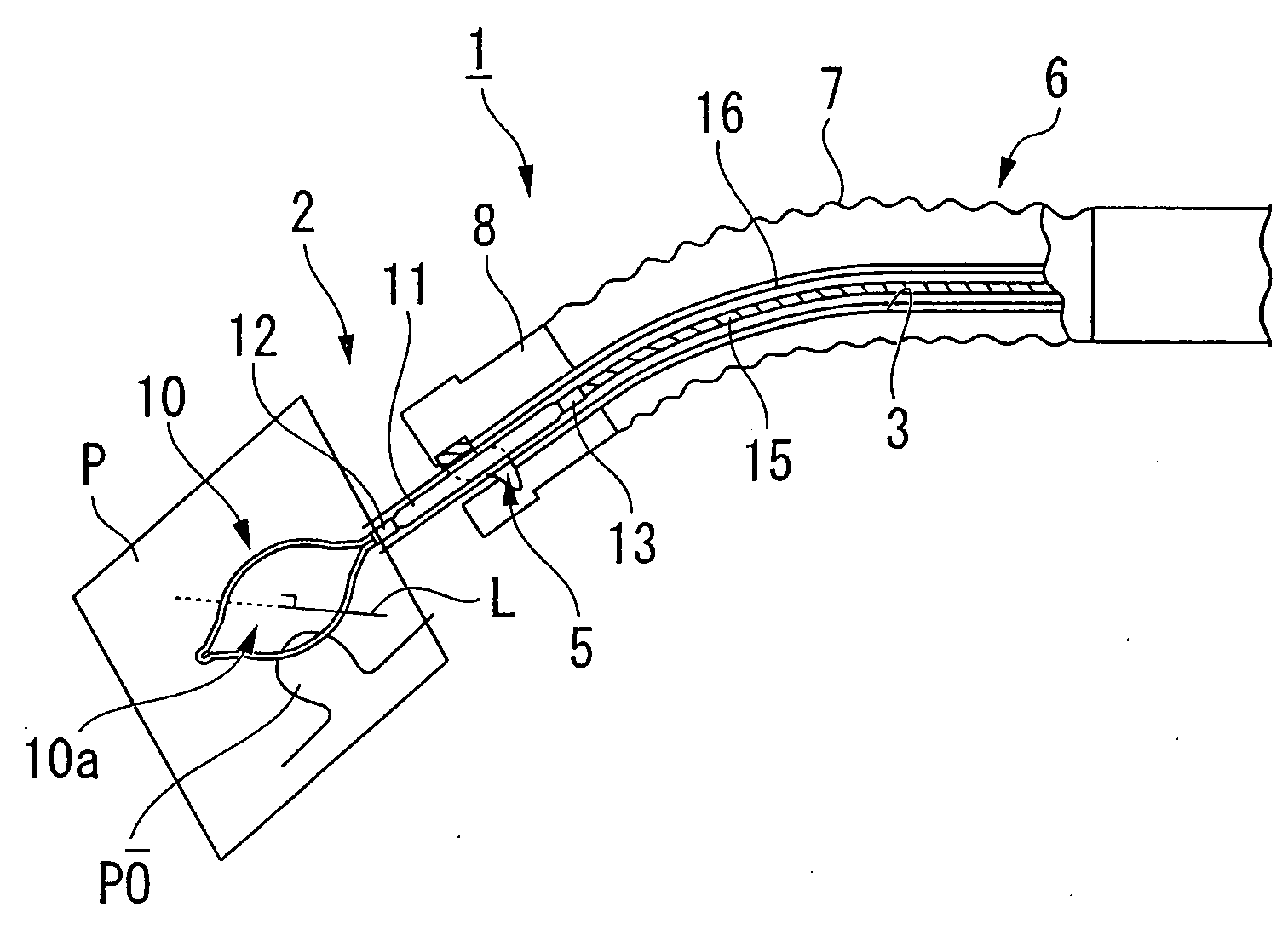 Endoscopic treatment instrument and endoscope system