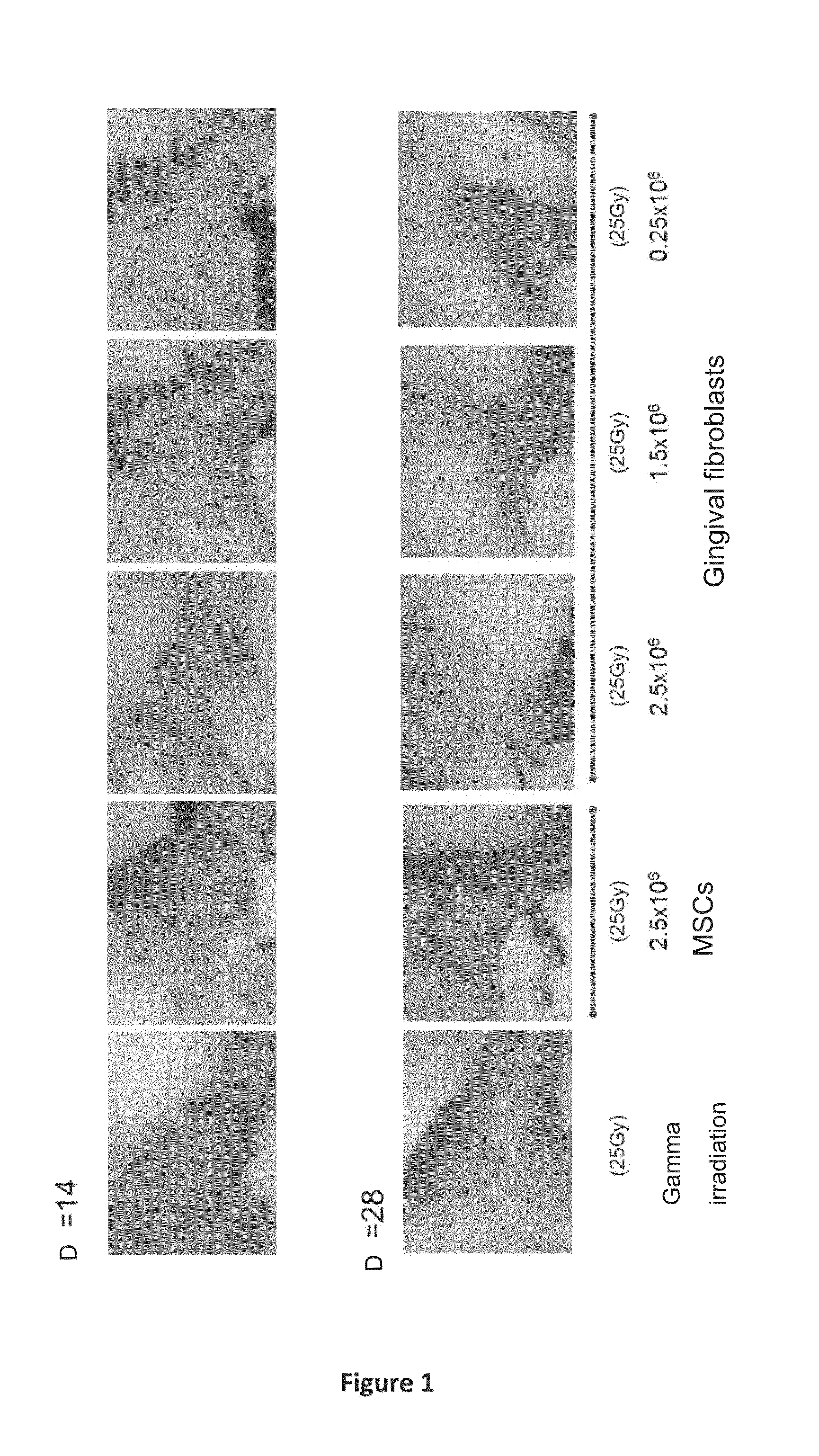 Use of gingival fibroblasts in the treatment of alopecia