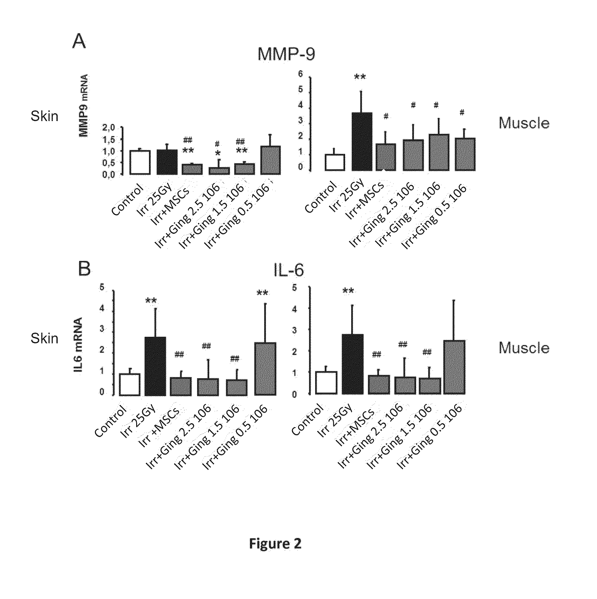 Use of gingival fibroblasts in the treatment of alopecia