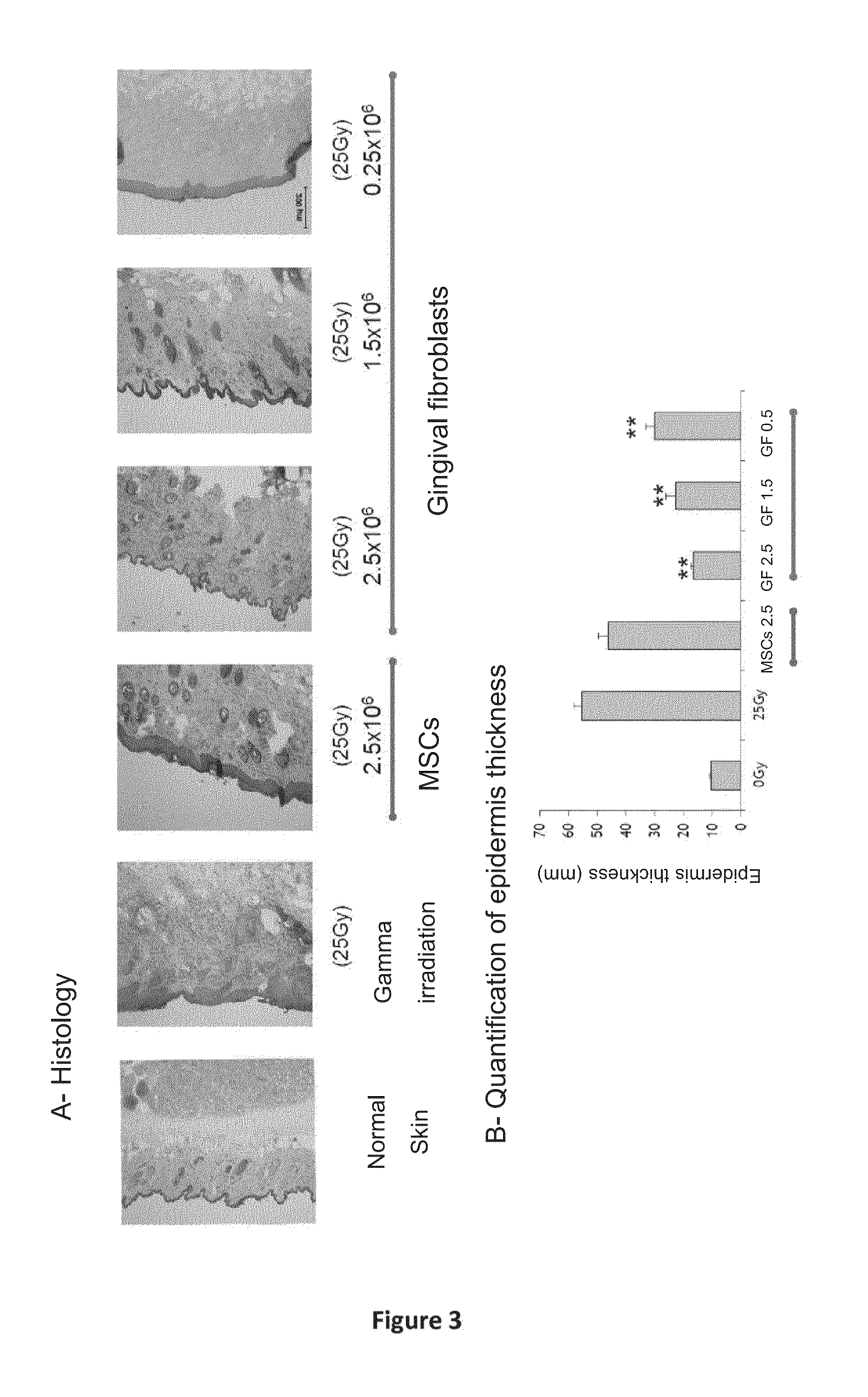 Use of gingival fibroblasts in the treatment of alopecia