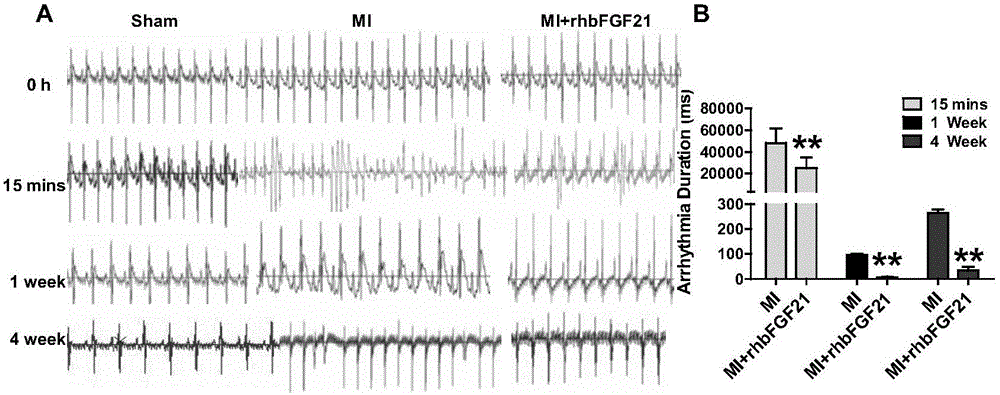 Application of recombination human fibroblast growth factor-21 in preparation of medicament for preventing and treating ischemic arrhythmia