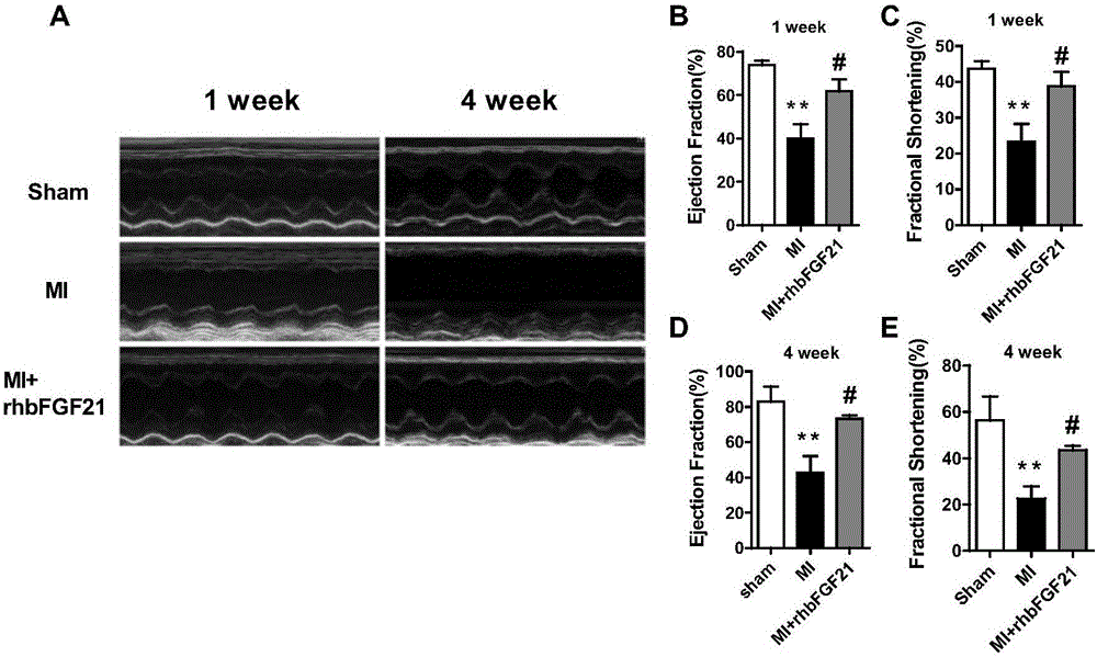 Application of recombination human fibroblast growth factor-21 in preparation of medicament for preventing and treating ischemic arrhythmia